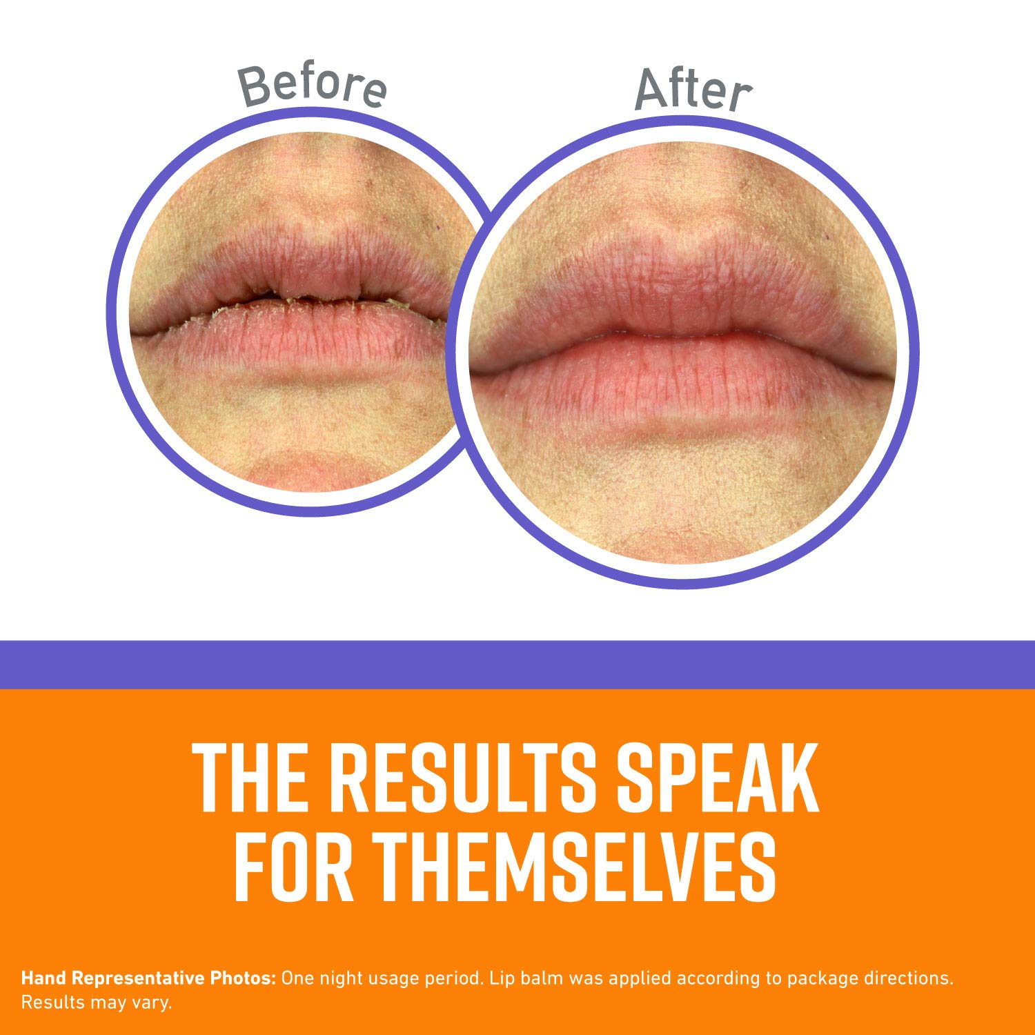 OKeeffes Lip Repair Night Treatment Lip Balm .25oz Jar,K3015207