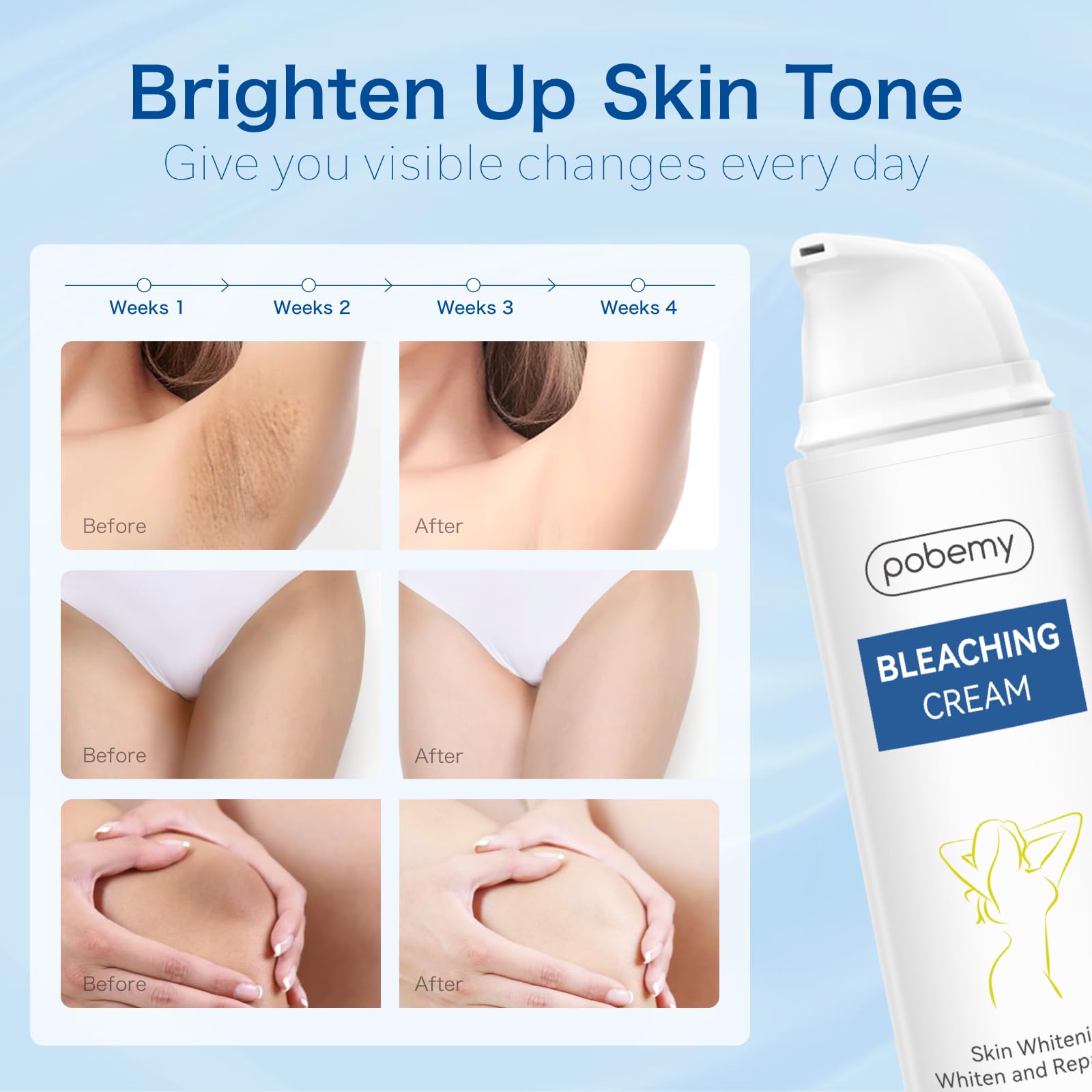 Pobemy Skin Bleaching Cream, Dark Spot Remover for Face, Intimate Areas & Body, Vitamin C Whitening for Underarms, Knees, Elbows, Inner Thighs, Bikini Line – Sensitive Skin Lightening Cream- 1.7FL OZ