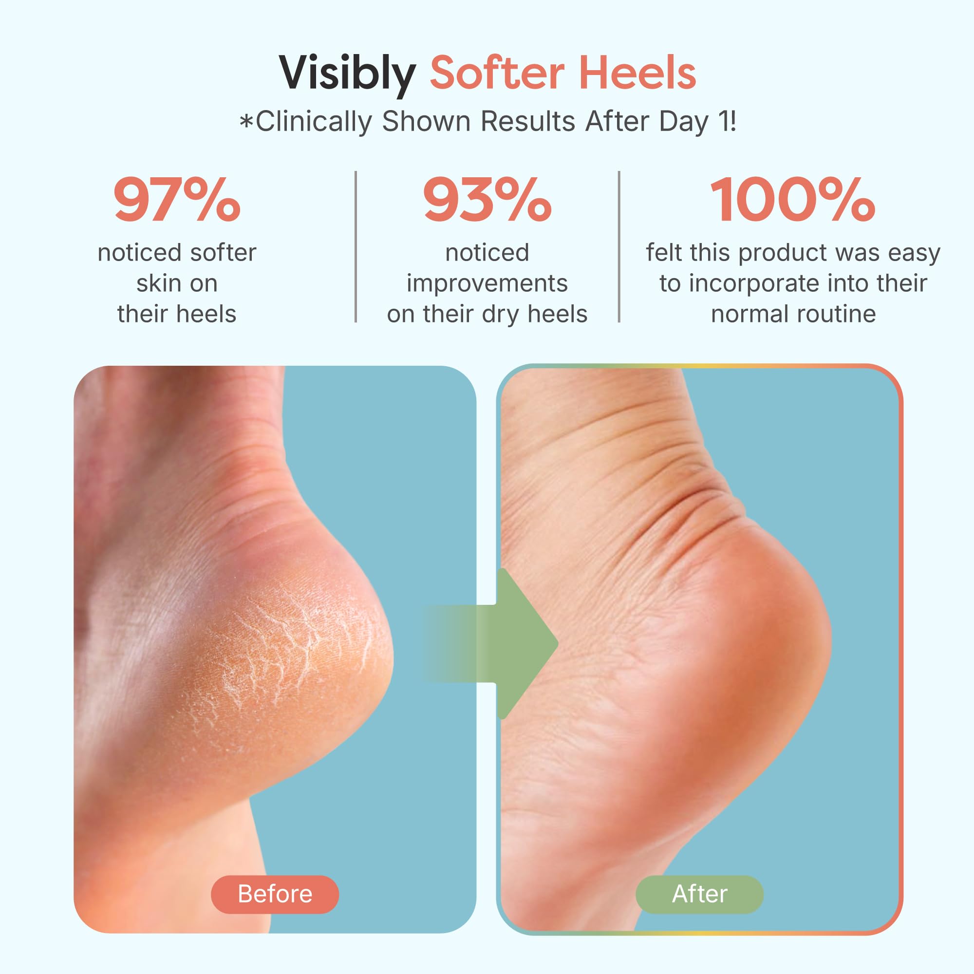 ZenToes Moisturizing Fuzzy Sleep Socks with Vitamin E, Olive Oil and Jojoba Seed Oil to Soften and Hydrate Dry Cracked Heels (Regular, Blue)