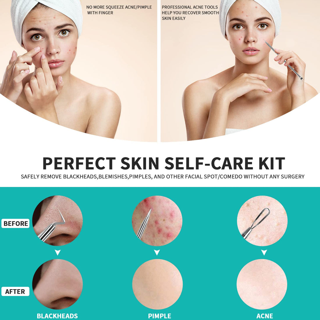 WSYUB Pimple Popper Tool, Stainless Steel Pimple Extractor, WSYUB Blackhead Tweezers, Comedones Extractor Acne Removal Kit for Blemish, Whitehead Popping