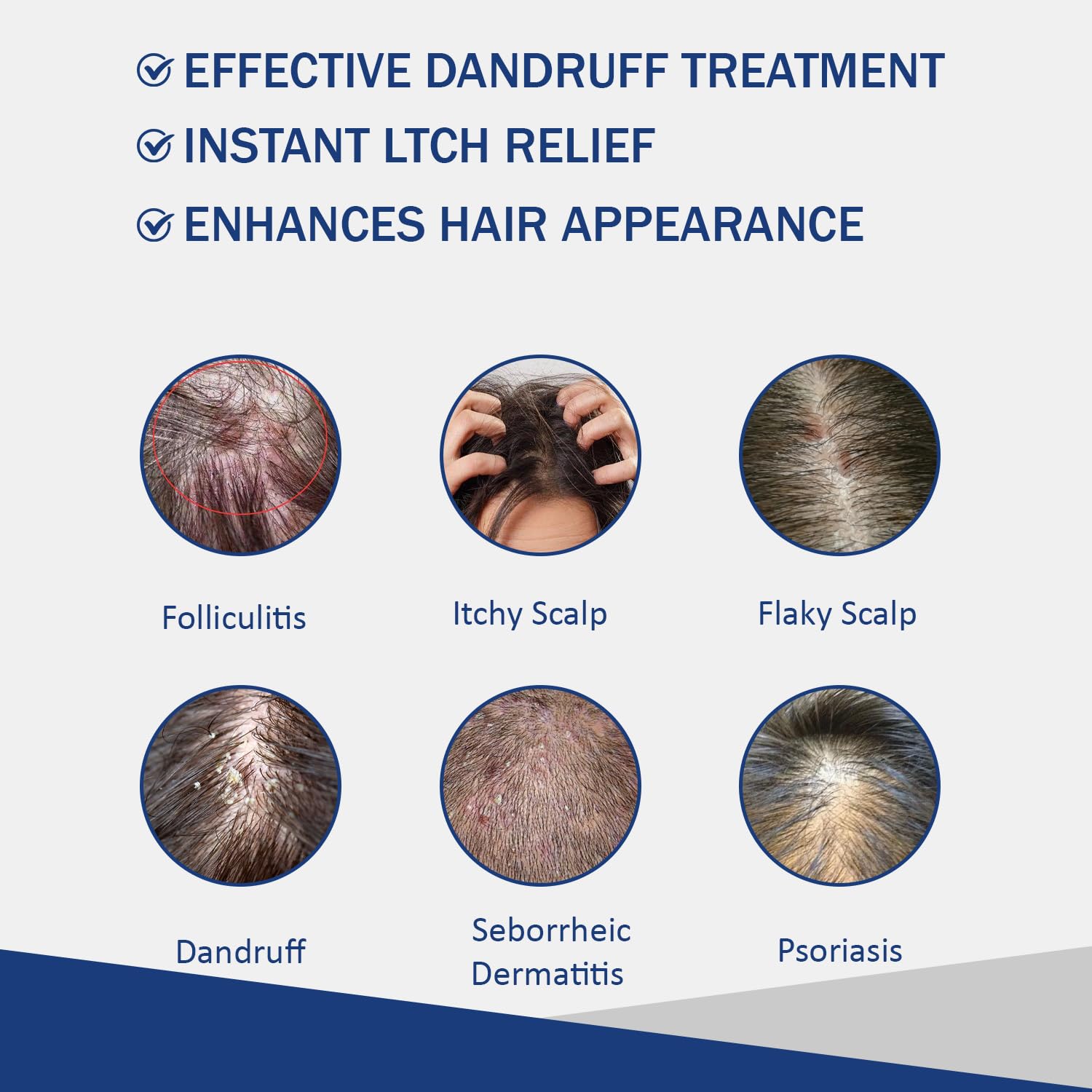 Sulfate Free - Anti Fungal Folliculitis Treatment Shampoo With Formula for Prone to Folliculitis,Seborrheic Dermatitis,For Normal to Oily Scalp Relieves Itchy & Dry Scalp, Dandruff - 10.1 Oz