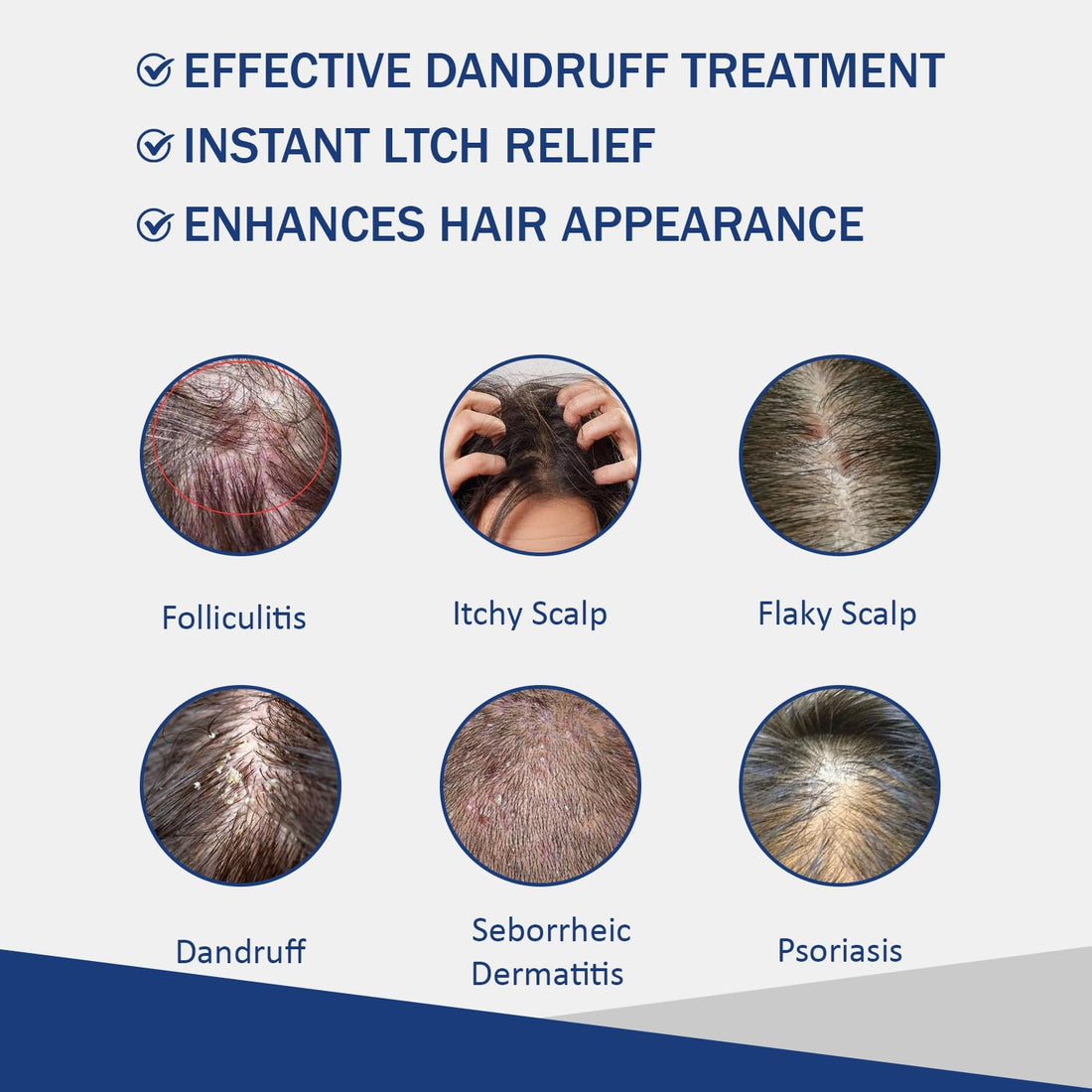 Sulfate Free - Anti Fungal Folliculitis Treatment Shampoo With Formula for Prone to Folliculitis,Seborrheic Dermatitis,For Normal to Oily Scalp Relieves Itchy & Dry Scalp, Dandruff - 10.1 Oz