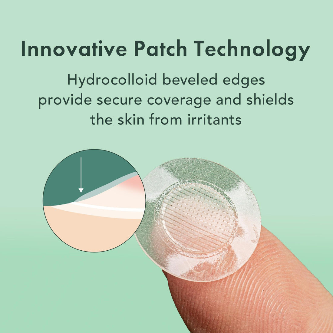 Rael Pimple Patches, Miracle Microcrystal Spot Cover - Hydrocolloid Acne Patches for Early Stage, with Tea Tree Oil, for All Skin Types, Vegan, Cruelty Free (36 Count)