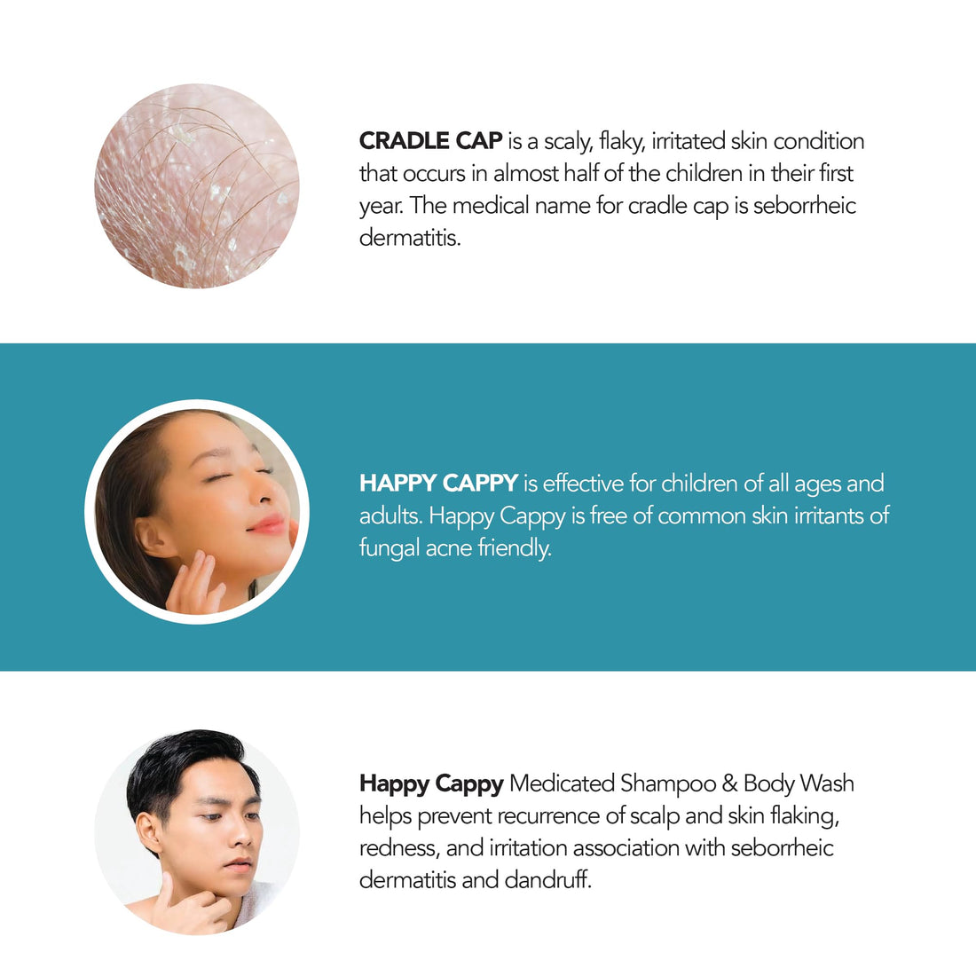 Happy Cappy Dr. Eddie’s Medicated Shampoo and Body Wash- Baby Dandruff Shampoo, Helps Cradle Cap and Seborrheic Dermatitis, Reduces Redness, Dermatologist Tested, Fragrance-Free- 8 Fl Oz (Pack of 4)