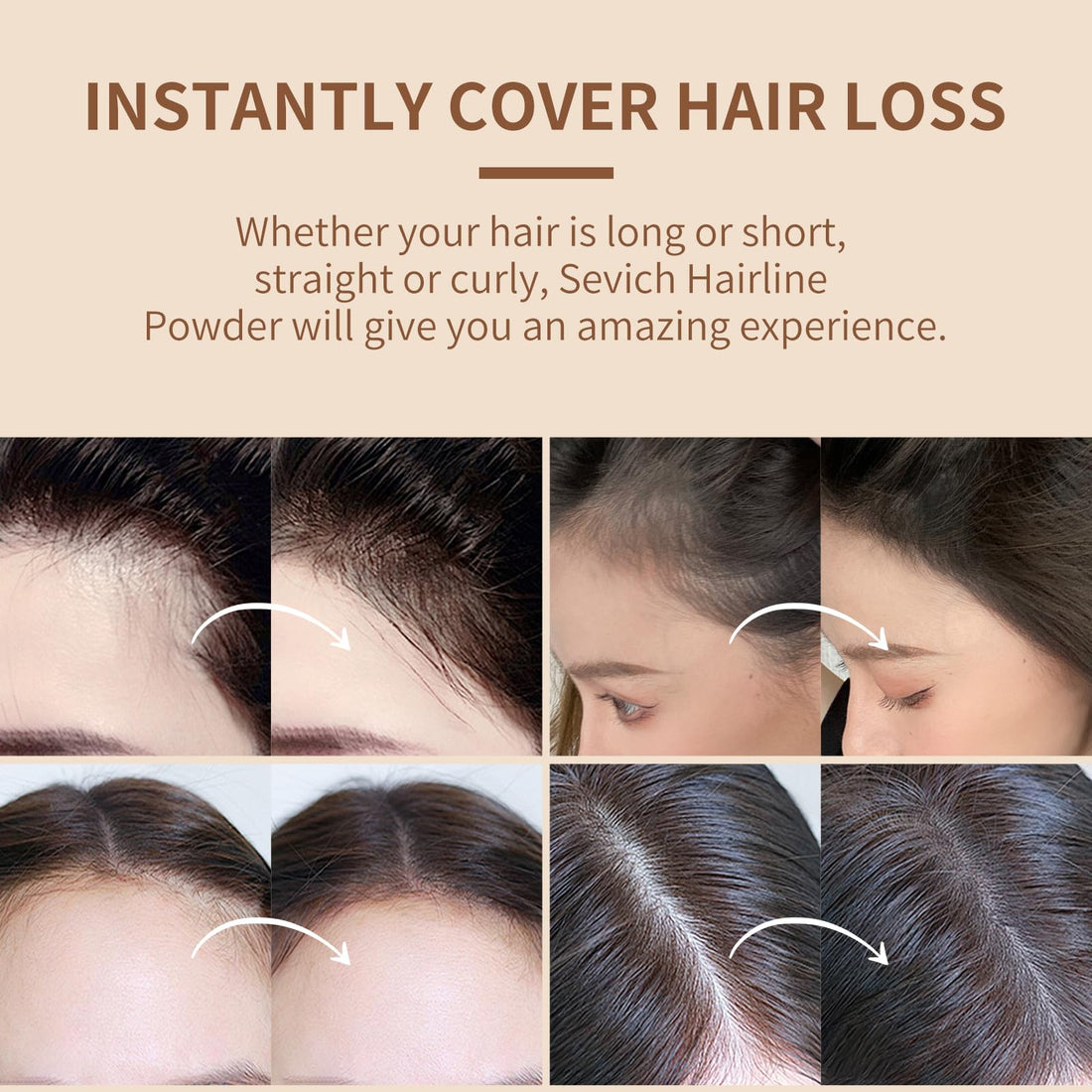 Sevich Hairline Powder,Instantly Conceals Hair Loss, Root Touch up Powder, Hair Shadow Toppers for Women & Men, Touch Up for Thinning Gray Hair, Windproof & Sweatproof, Medium Brown