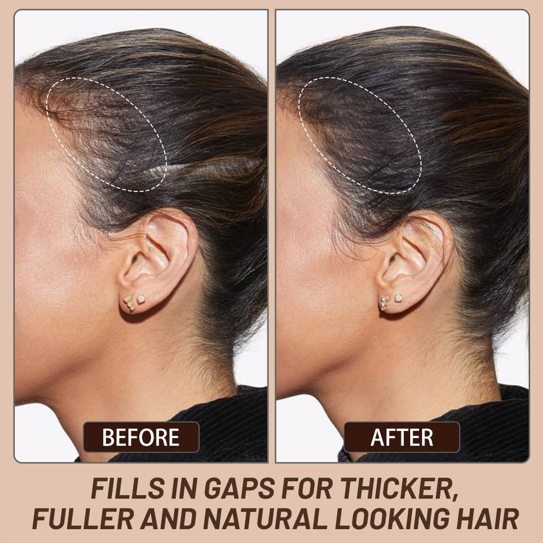 VOLLUCK Root Touch up Powder, Instant Hairline Powder for Thinning Areas and Gray Hair Coverage, Natural and Non-greasy Root Cover up for Women and Men (Light Brown, 0.35 Ounce)