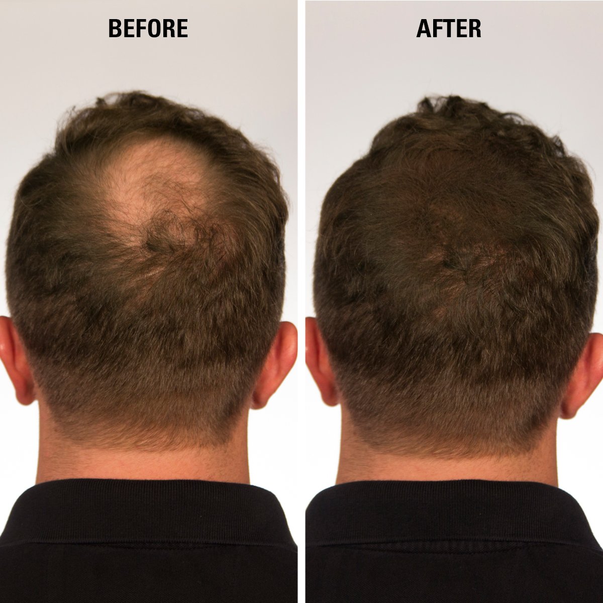 Eclipse Hair Fibers for Thinning Hair (DARK BLONDE) For Women & Men - 100% Undetectable Fibers - 15g Bottle - Completely Conceals Hair Loss in 15 Seconds