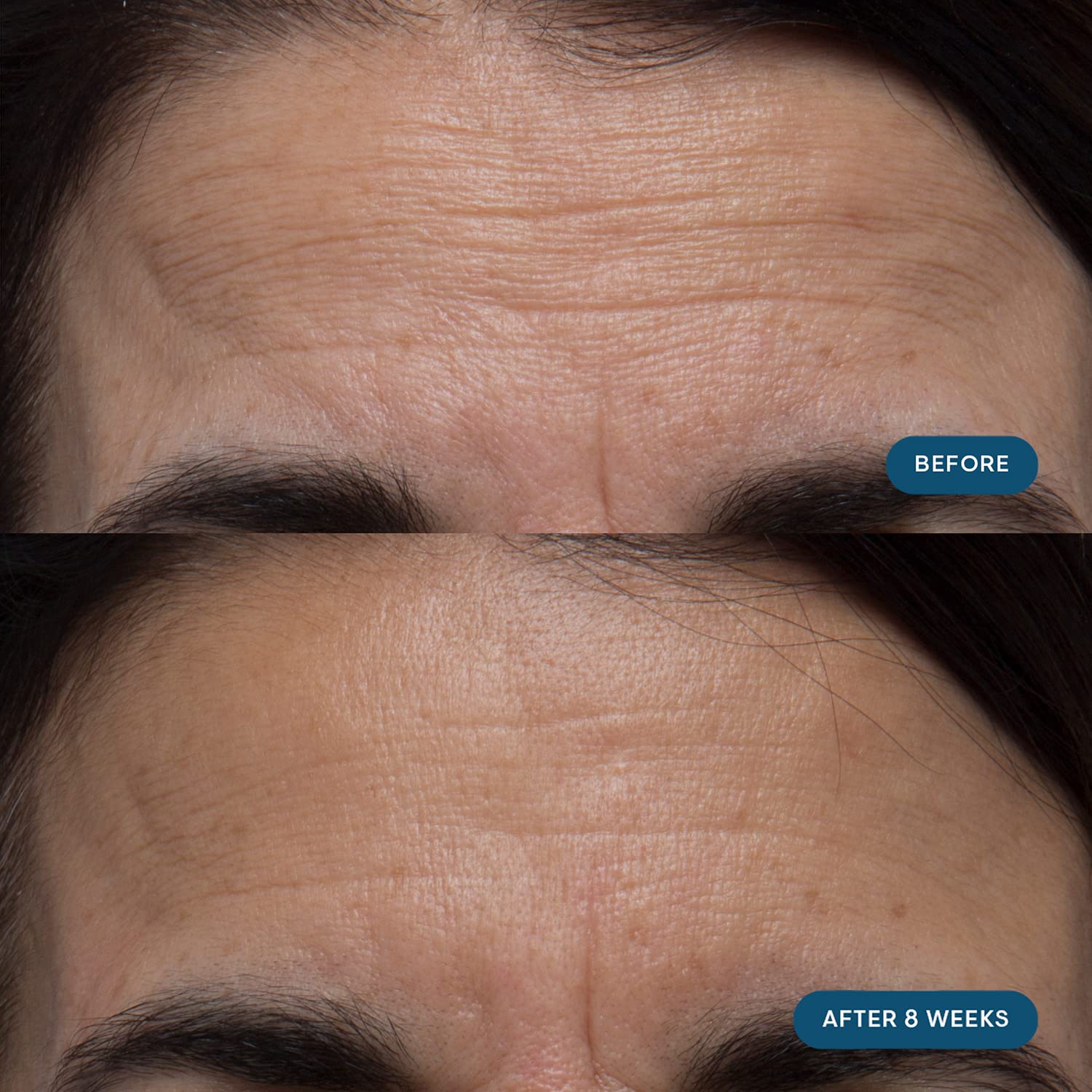 ELEMIS Pro-Collagen Skin Future Supplements, Daily Ingestible Reduces the Look of Fine Lines & Wrinkles, Supports Hydration & Elasticity, 60 Capsules