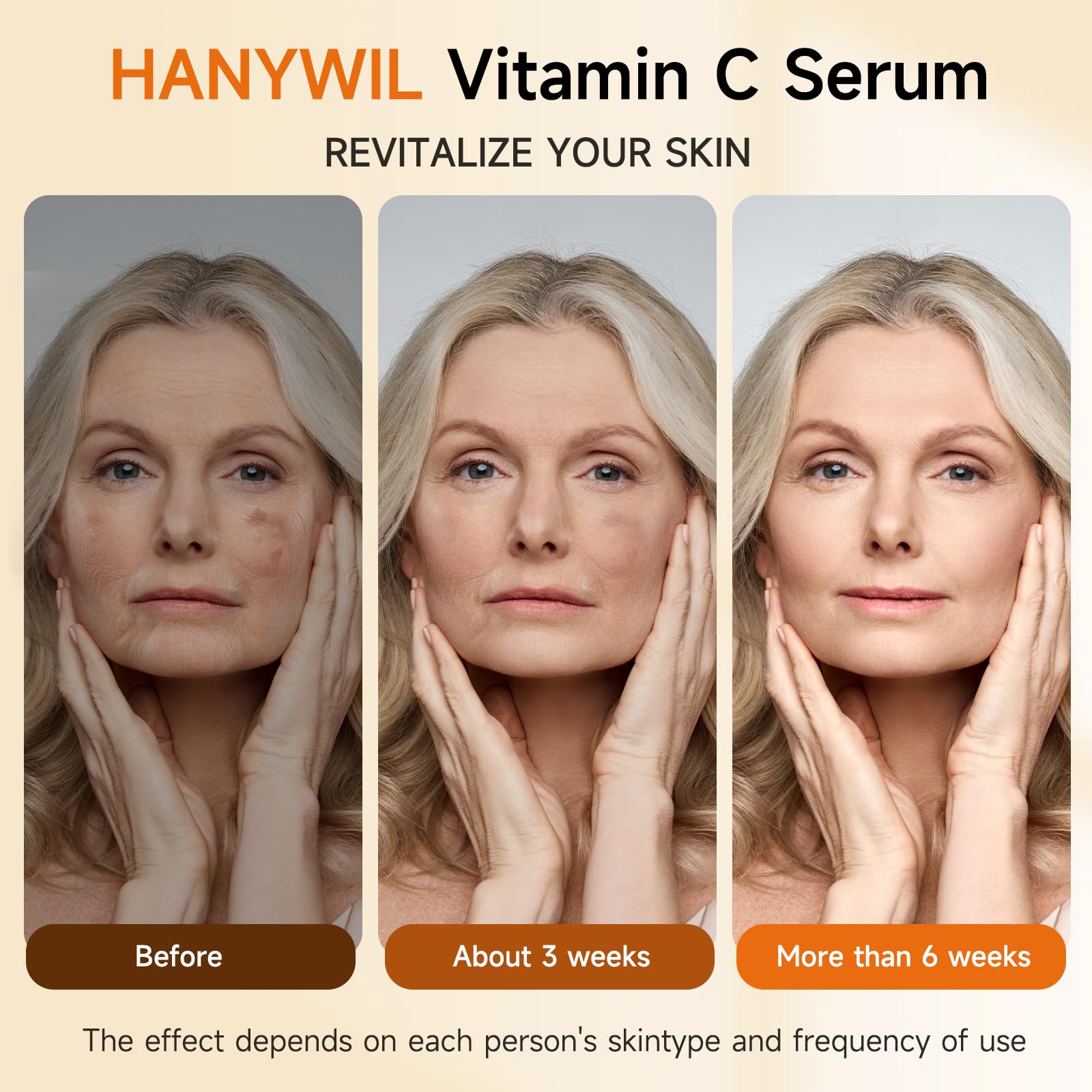 HANYWIL Super Vitamin C Serum for Women over 70, Vitamin C Serum for Face, Dark Spot Remover for Face, Hyaluronic Acid Skin Care, Targets Age Spots, Hydrates and Wrinkle Reduction 1.7fl oz