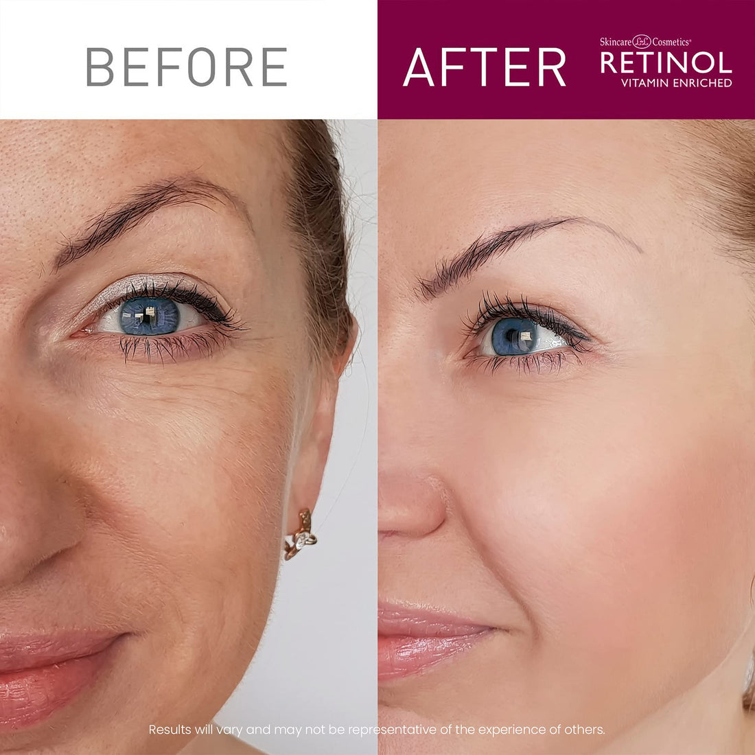 Retinol Cream Cleanser Anti-Aging – 5oz – Daily Deep Cleansing Facial Wash Improves Skin Texture, Moisturizes, And Exfoliates for Softer Face – Renewing Vitamin A Minimizes Wrinkles and Fine Lines