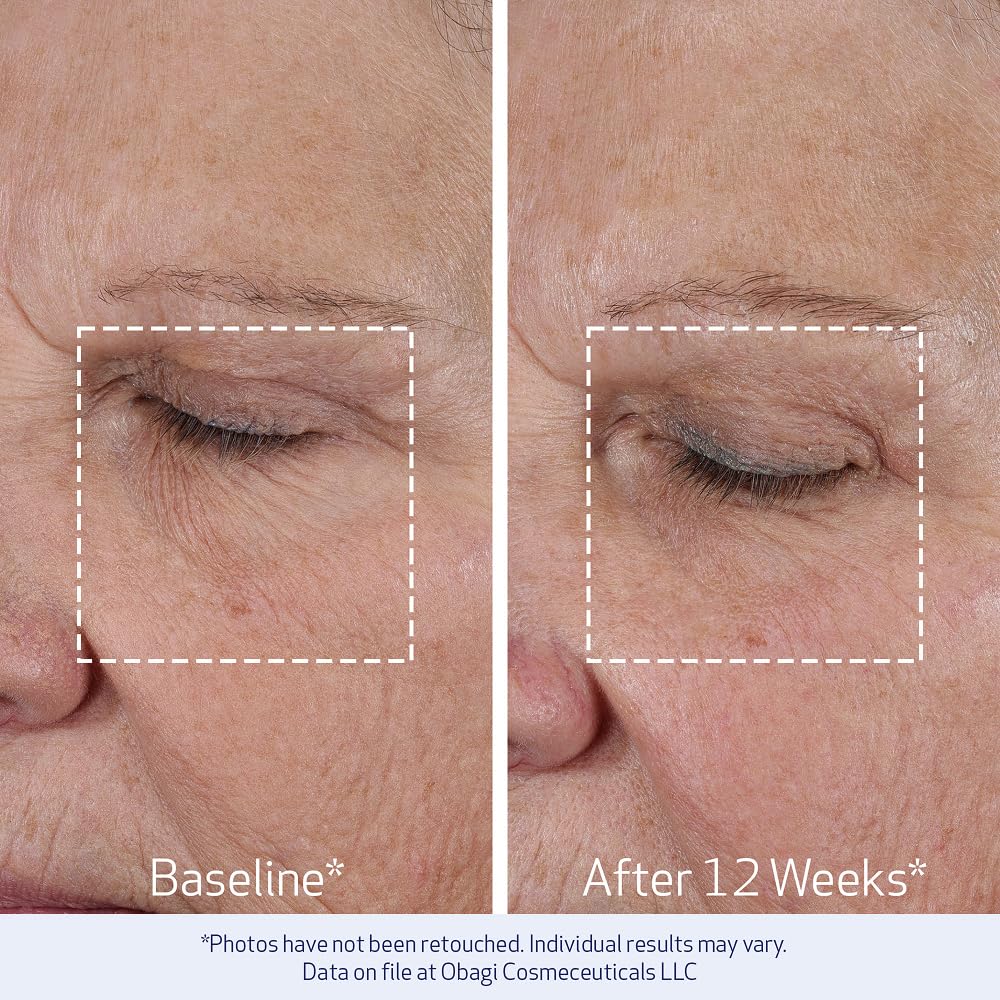 Obagi ELASTIderm Lift Up & Sculpt Facial Moisturizer – Clinically Proven Anti-Aging Face Cream that Visibly Firms & Sculpts Facial Contours, & Reduces Fine Lines & Wrinkles with Peptides – 1.7 oz