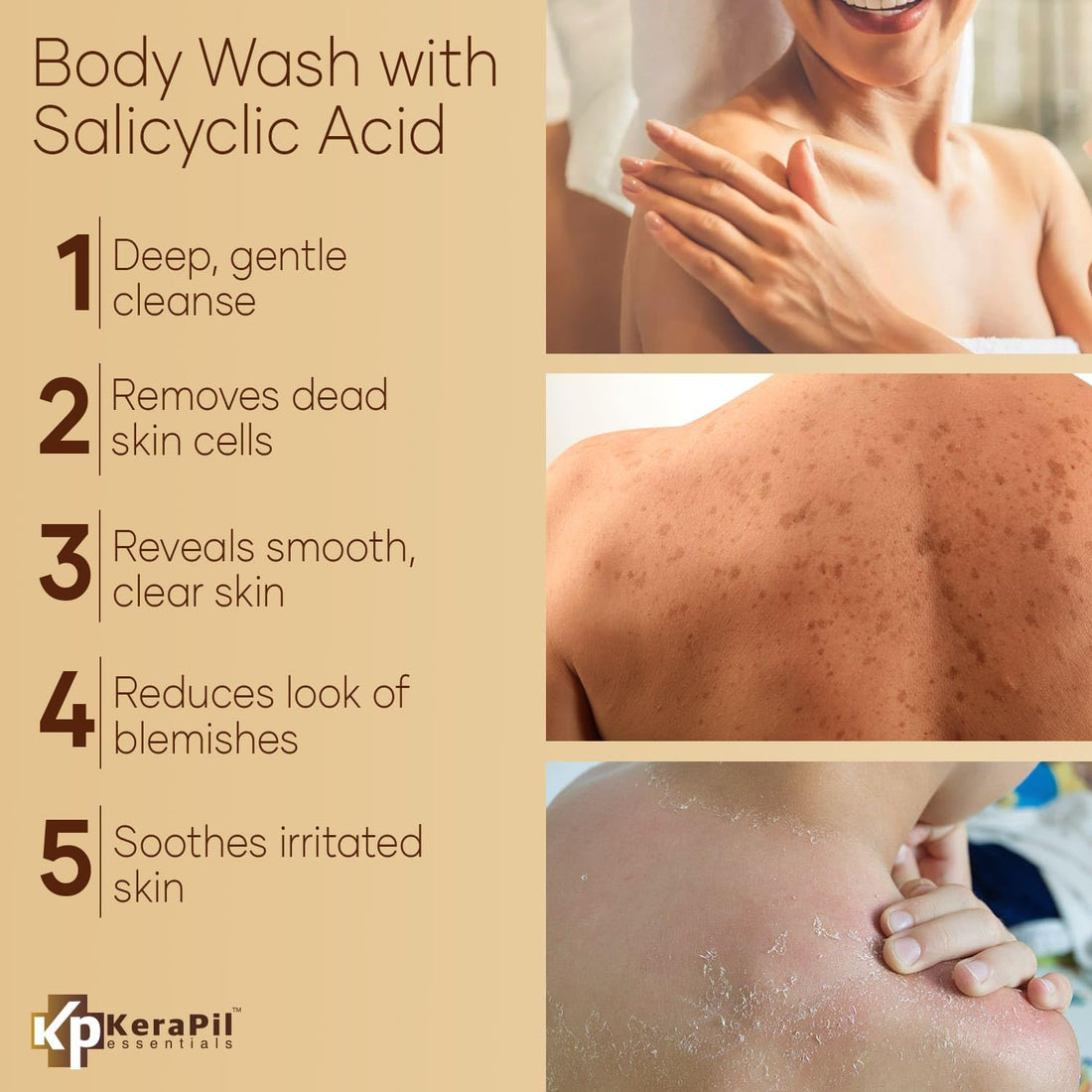 KERAPIL Exfoliating Body Wash with Salicylic Acid - No Dry Out, Gentle Exfoliates Rough and Bumpy Skin, Body Acne Wash, BHA & AHA - Coconut and Vanilla Salicylic Acid Body Wash - (16 fl oz)