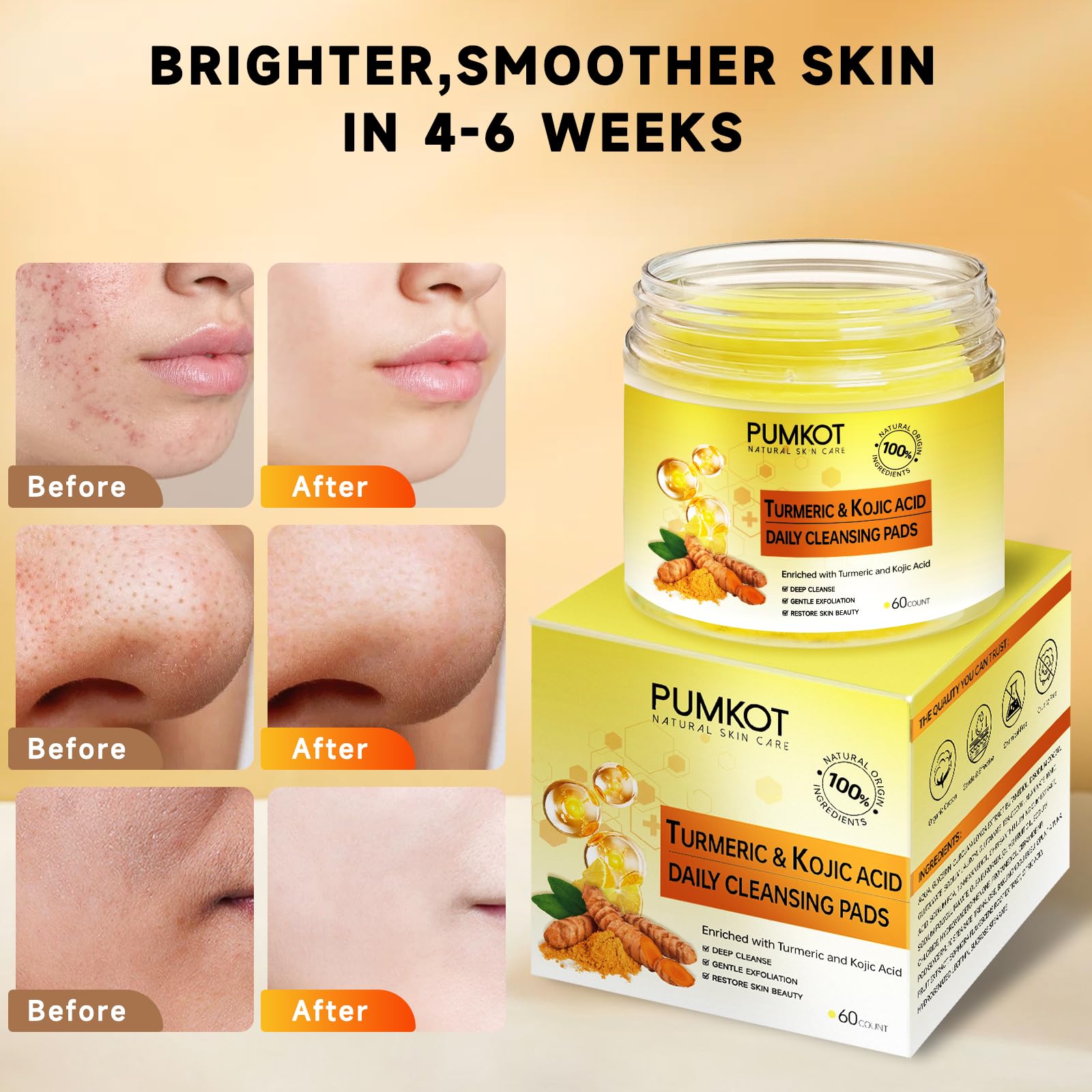 Turmeric Kojic Acid Cleansing Pads, Turmeric Face Scrub Pads Enriched with Kojic Acid and Turmeric, 60PCS