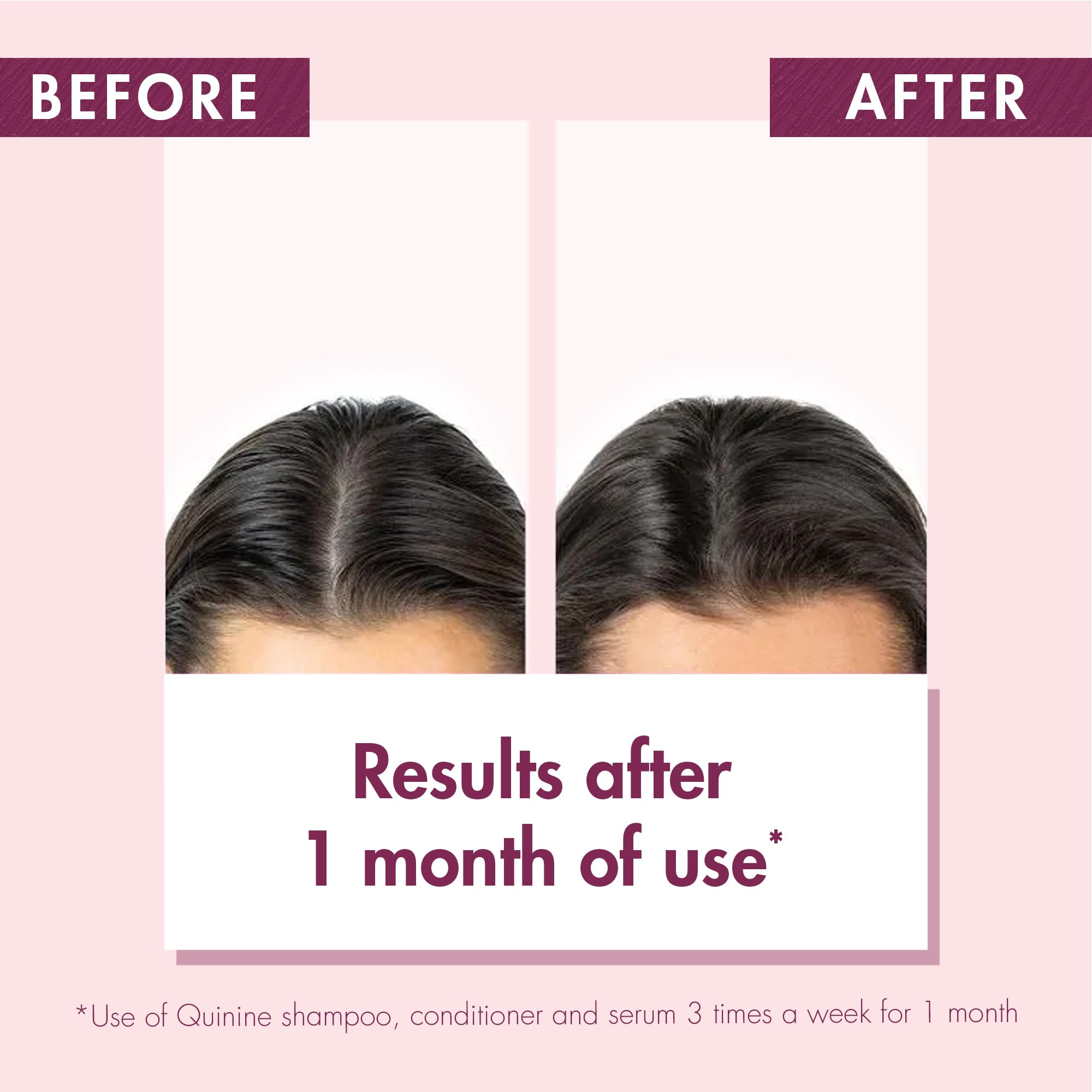 Klorane - Strengthening Shampoo - with Quinine & Edelweiss For Thinning Hair - Support Thicker Hair - Silicone, Paraben & Sulfate Free - 13.5 fl. oz.