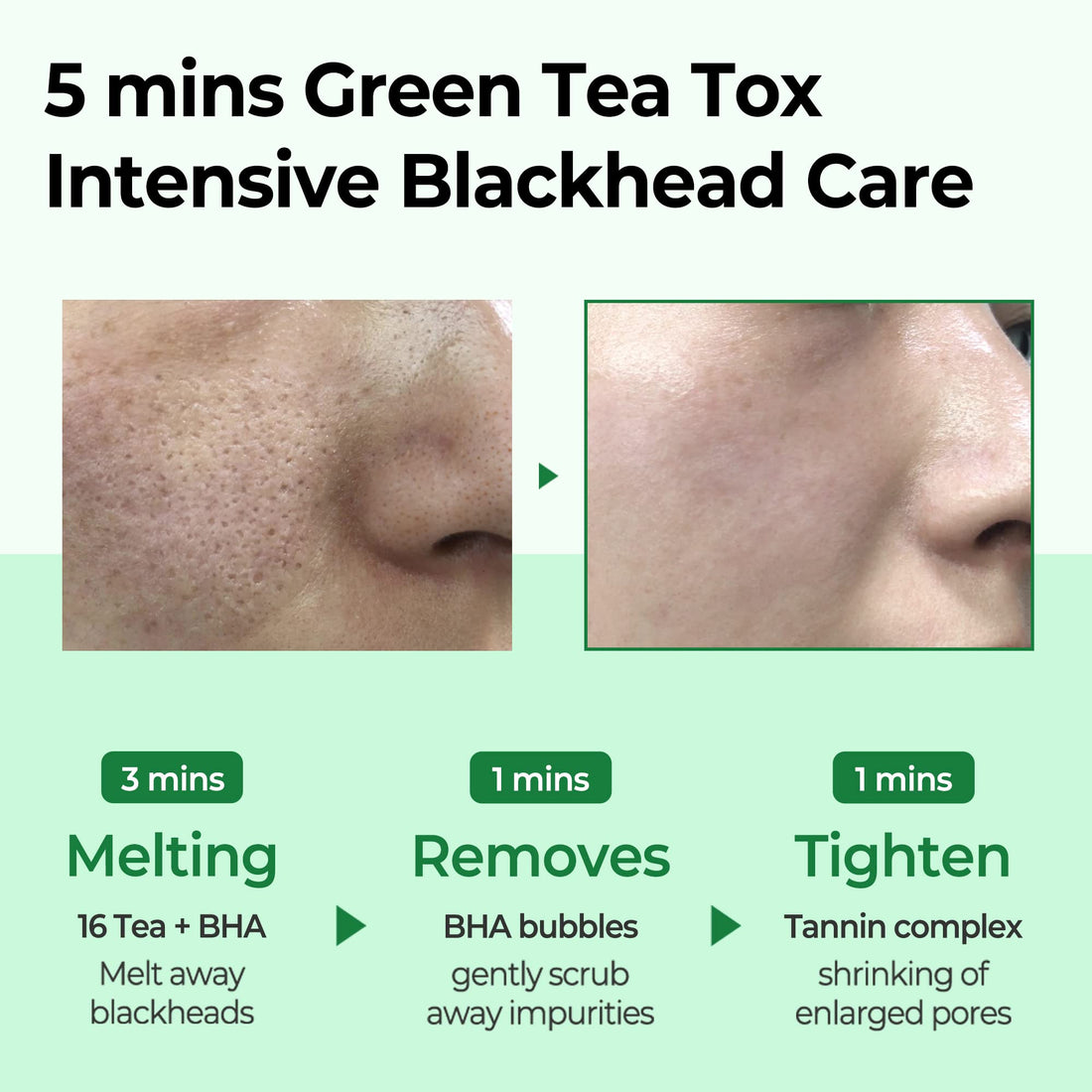SOME BY MI BYE BYE BLACKHEAD 30 DAYS MIRACLE GREEN TEA TOX BUBBLE CLEANSER (120g)