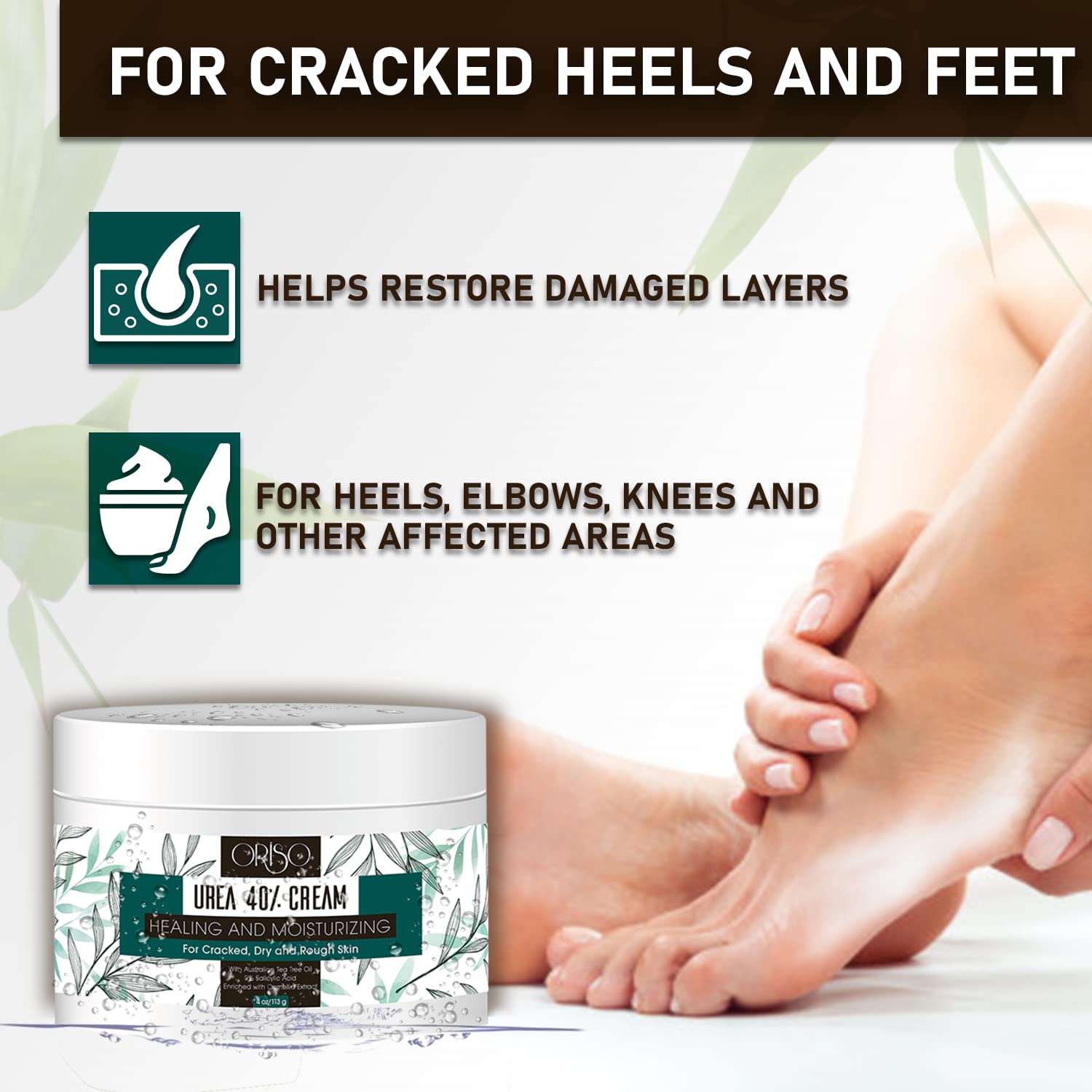Urea Cream 40 Percent - Intensive Hydration for Dry and Cracked Heels, Feet, Hands, Elbows and Knees - Callus Remover for Women with Salicylic Acid - Helps Athletes Foot - Foot Odor - 4 oz