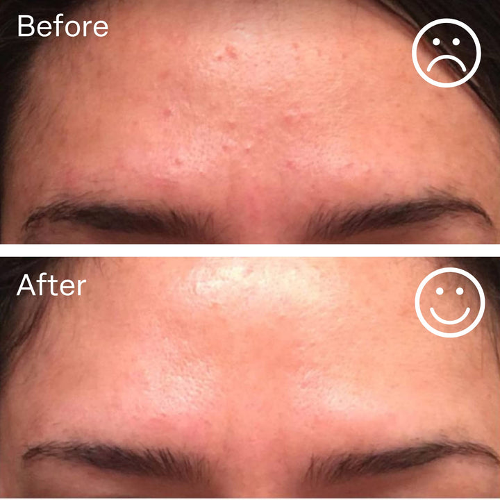 nuorganic Hyaluronic Acid + B5 + Plant Stem Cells: Skin Feels Hydrated, Plumper, Dewy and Rejuvenated - PhytoCellular Science + Multi Molecular + 100 Hour Hydration + Better Skin in 7 Days