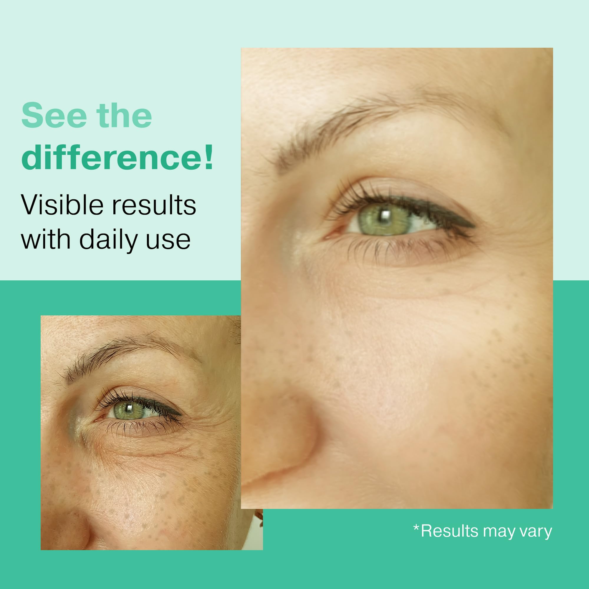 2X BIGGER 2OZ, Go Radiance 5% Glycolic Acid Serum, Salicylic Acid Serum for Acne-prone Skin, BHA Liquid Exfoliant, AHA Peel Lactic Acid Serum, Gentle Glycolic Acid Peel For Oil Control & Pore Reducer