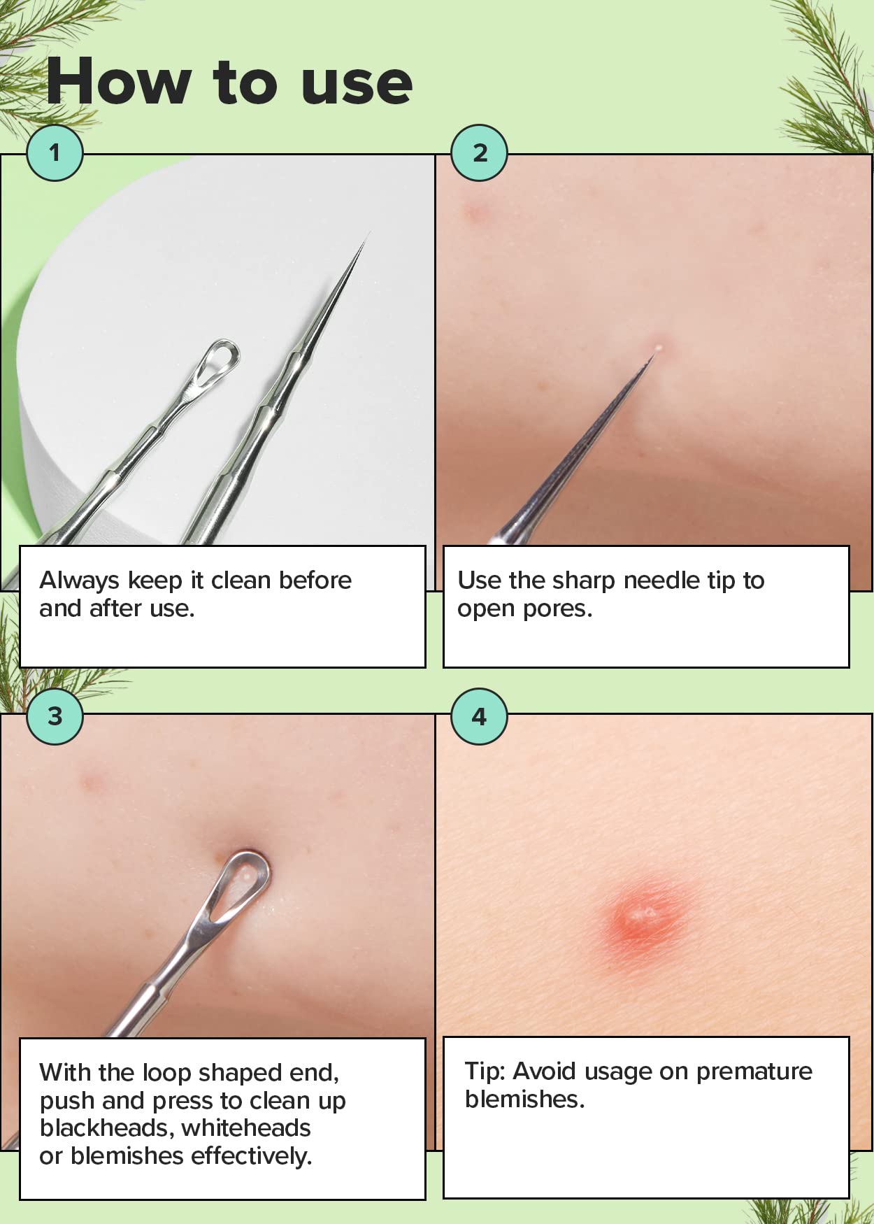 I DEW CARE Dual-Tip Pimple Tool - Proper Popper | Blackhead Remover, Blemish Exfoliating, Professional Acne Squeezer, Comedone Zit Extractor for Women, Stainless Steel, Mother's Day, 1ea