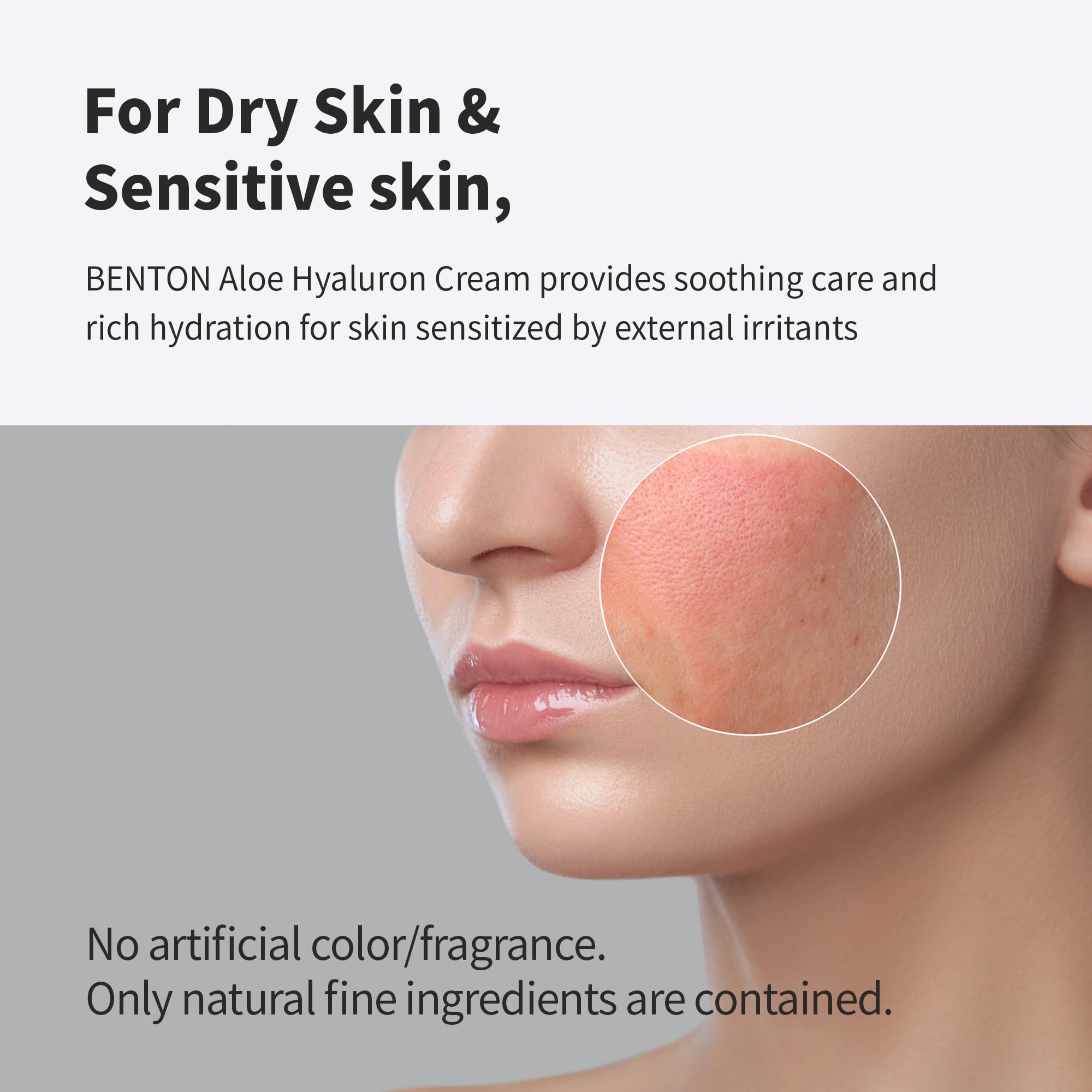 BENTON Aloe Hyaluron Cream 50g (1.76 oz.) - Aloe Leaf Water & Hyaluronic Acid Contained Soothing and Moisturizing Facial Cream, for Dryness and Itchy Senstivie Skin