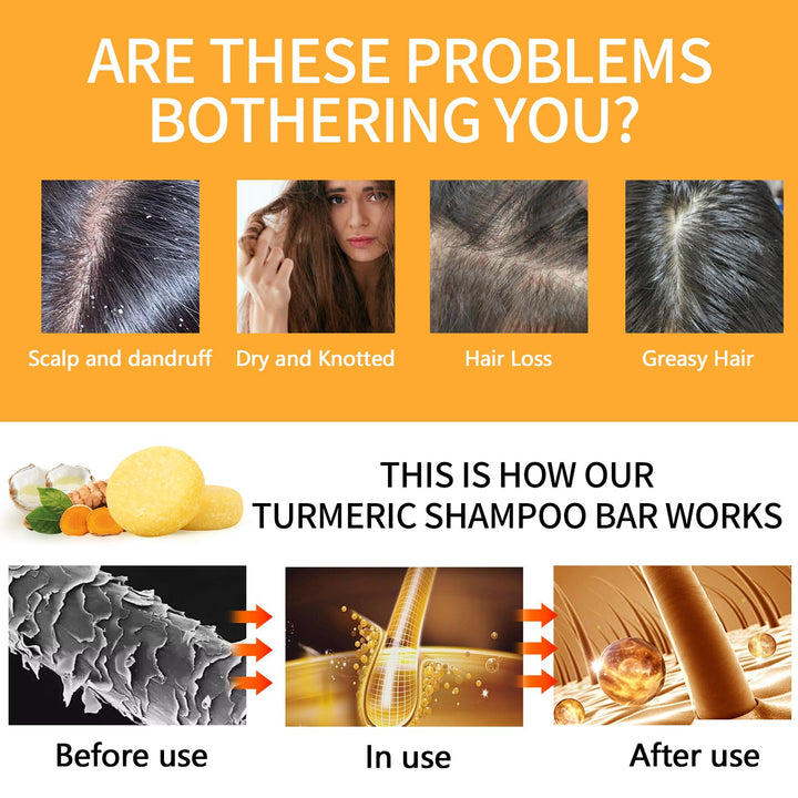BYOTOUTY Ginger Shampoo Bar with Coconut Oil 2 Pack, Organic Turmeric Ginger Solid Soap Shampoos Bars, Natural Hair Growth Bar Shampoo for Women 4.23oz/120g, Christmas Presents