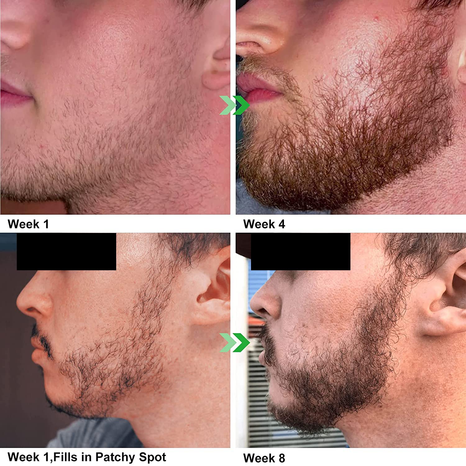 Unscented Beard Oil - Natural, Non-GMO, Facial Hair Hydrating & Conditioning Oil Blend - 32 oz - Bulk Sized, Promoting Growth and Silky Smooth Hair - Jojoba, Argan & More