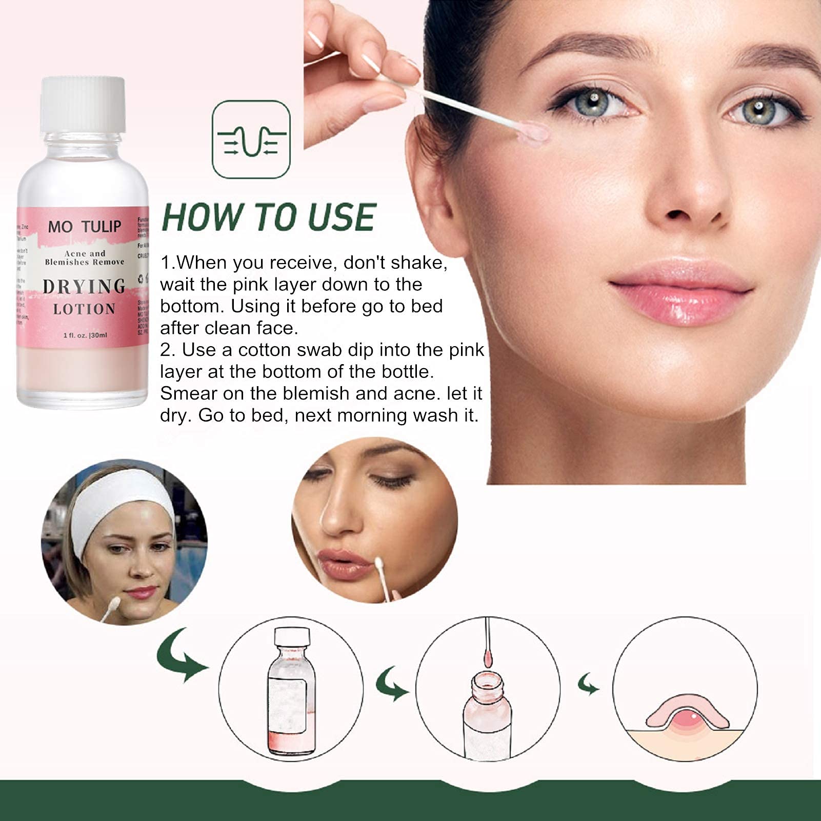 MO TULIP Acne Drying Lotion, Overnight Acne Acid and Acne Spot Treatment for Face and Body, Pimple Lotion Spot Treatment, Dry Out Pimples, Blemishes, and Clean pores (1OZ)