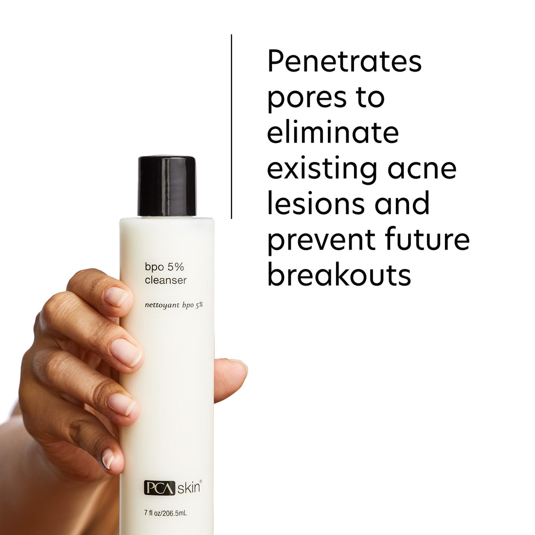 PCA SKIN 5% Benzoyl Peroxide Face Wash, Foaming Acne Facial Cleanser for Oily and Acne Prone Skin, Eliminates Existing Acne and Helps Prevent Future Breakouts, Cleanses and Calms, 7.0 Oz Bottle