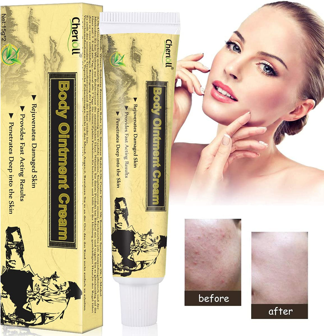 Moisturising Cream, Body and Face Moisturizer for Dry Skin, Acne Cream, 2PC