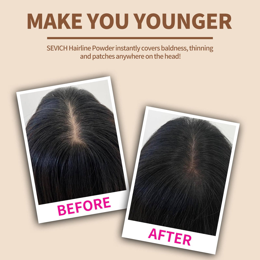 Sevich Hairline Powder,Instantly Conceals Hair Loss, Root Touch up Powder, Hair Shadow Toppers for Women & Men, Touch Up for Thinning Gray Hair, Windproof & Sweatproof, Medium Brown