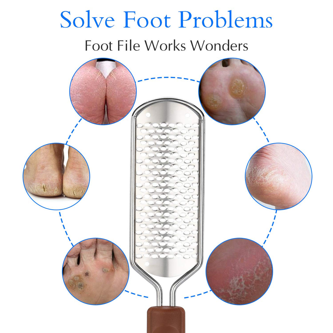 Foot File Callus Remover, Pefei Colossal Professional Stainless Steel Detachable Foot Scrubber, Hard Skin Removers Pedicure Rasp for Wet and Dry Feet