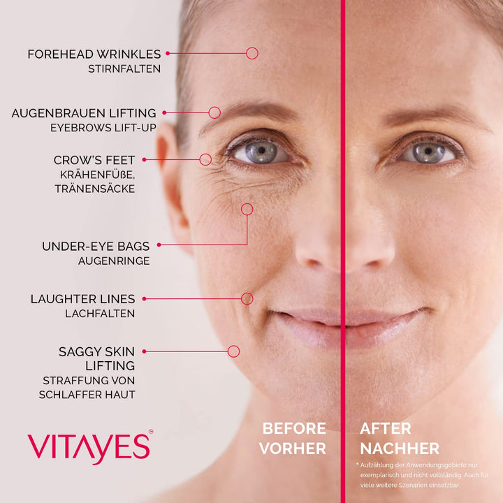 VITAYES Anti Aging Skin Care and Face Cream Moisturizer For Men and Women Instant Anti Wrinkle Day and Night Cream - Reduce Fine Lines and Age Spots in just 5 Minutes!