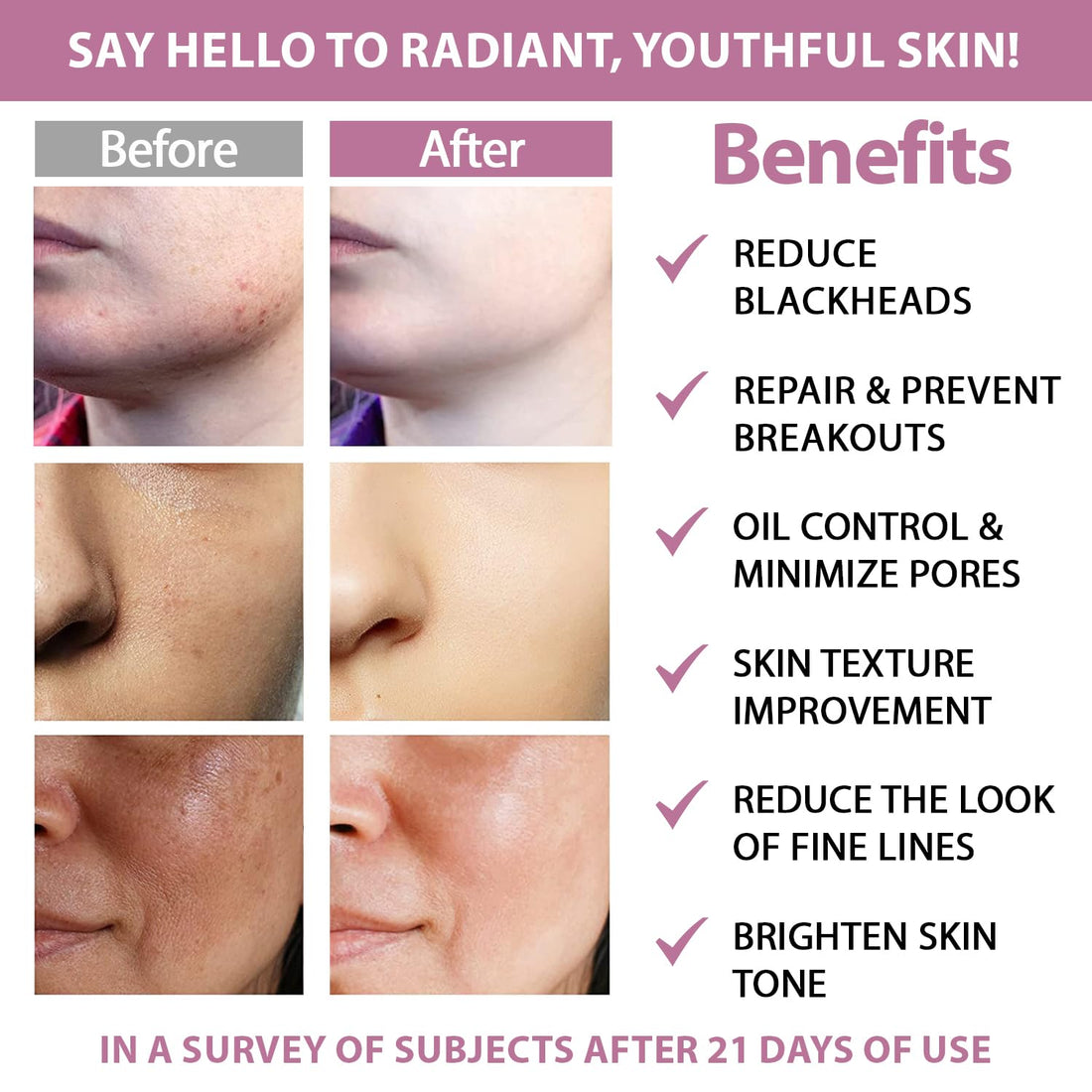 Glycolic Acid 20% & Salicylic Acid 2% Exfoliating Pads (50 Count)-HSA FSA Eligible Peel Wipes for Facial Cleansing, Resurfacing, Brightening, Blemish Control, Revealing Clear, Radiant, Youthful Skin