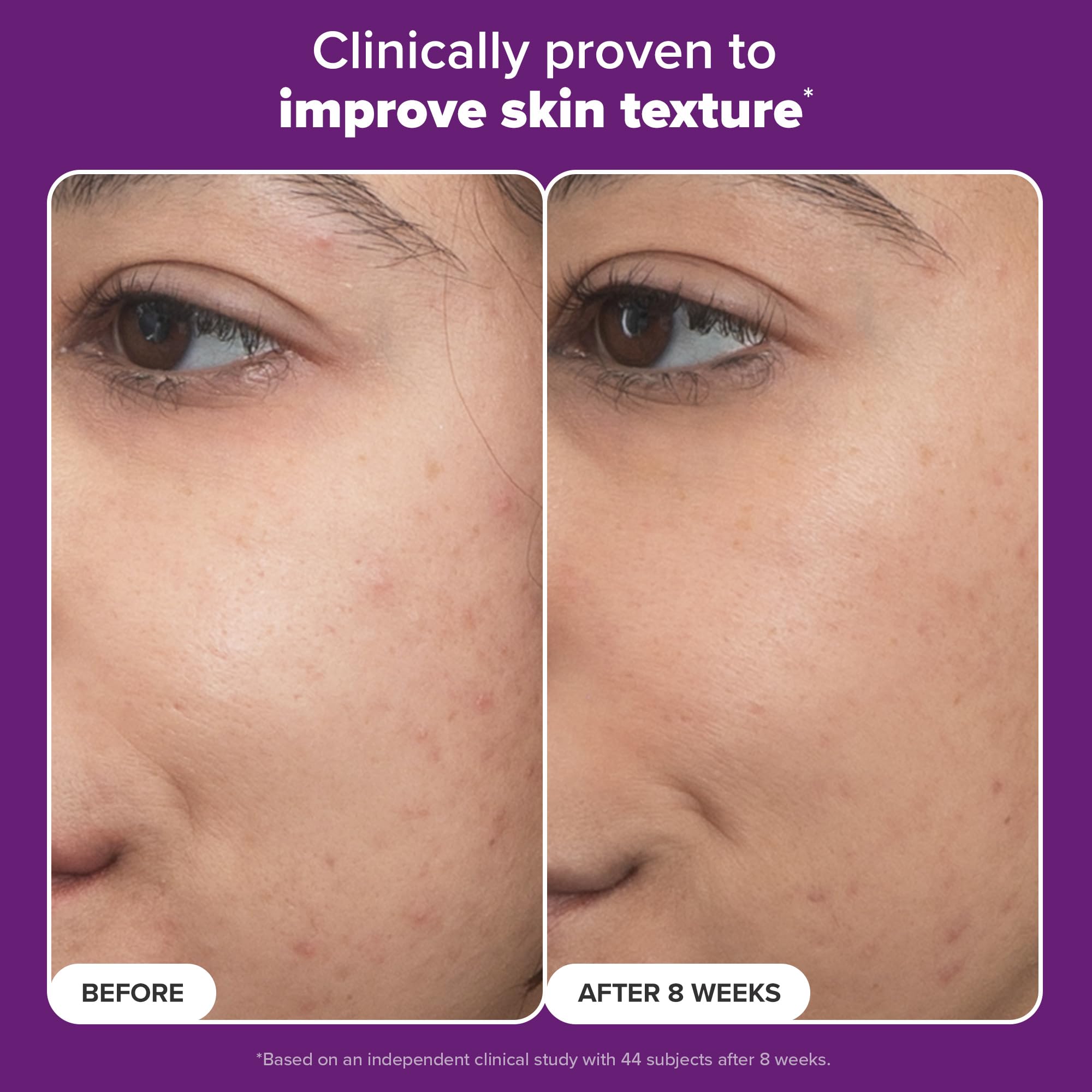 Paula’s Choice Pro Retinaldehyde Dual-Retinoid Advanced Treatment, High Potency Anti-Aging Serum for Breakout-Prone Skin, Radiance & Rough, Bumpy Texture, Fragrance-Free, 0.17 Fl. Oz.