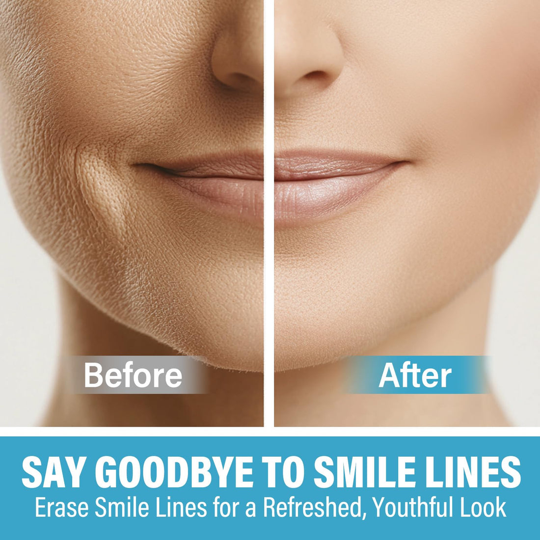 Feugole Smile Line Patches, Anti Wrinkle Patches for Face Overnight, Anti Wrinkle Facial Patches for Smile Lines Remover,16 Packs
