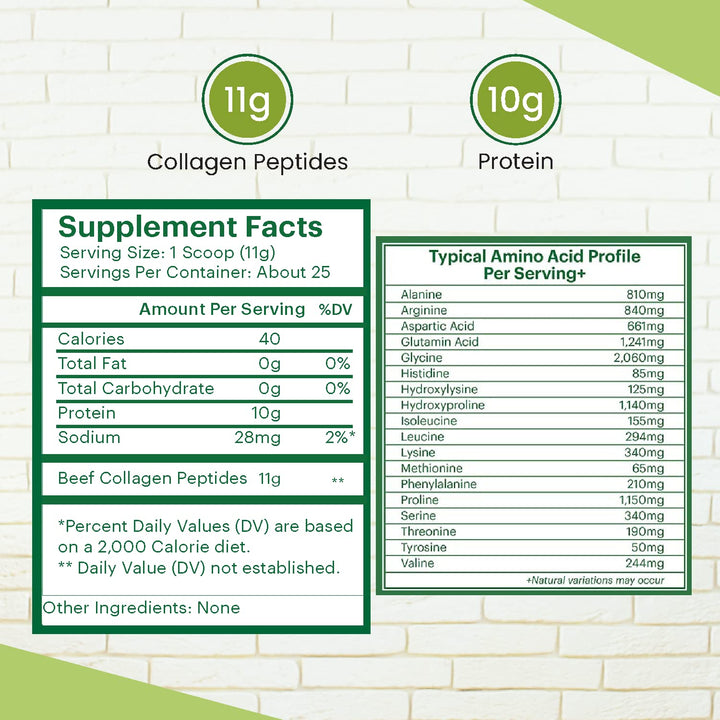 Zaytun Halal Collagen Peptides Powder, Hydrolyzed Type I & III Collagen, Supports Joint, Bone, Muscles, Hair, Skin, & Nails, Keto Friendly, Grass-Fed, 10 oz, Made in USA, Certified Halal