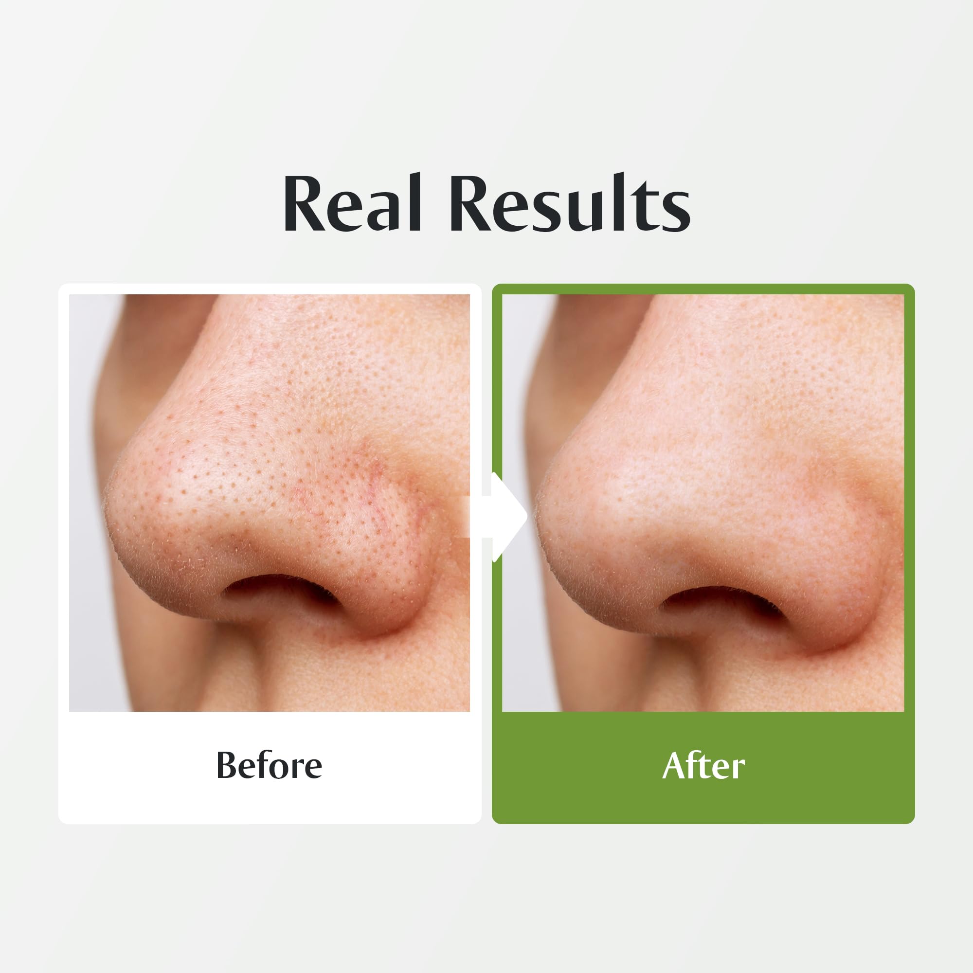 [Redence] Green Grape 3-in-1 Gelato Pore Mask Cleanser, Pore Exfoliating Scrub Mud Mask, No Tightness, Korean Skin Care, 100ml / 3.38 fl oz