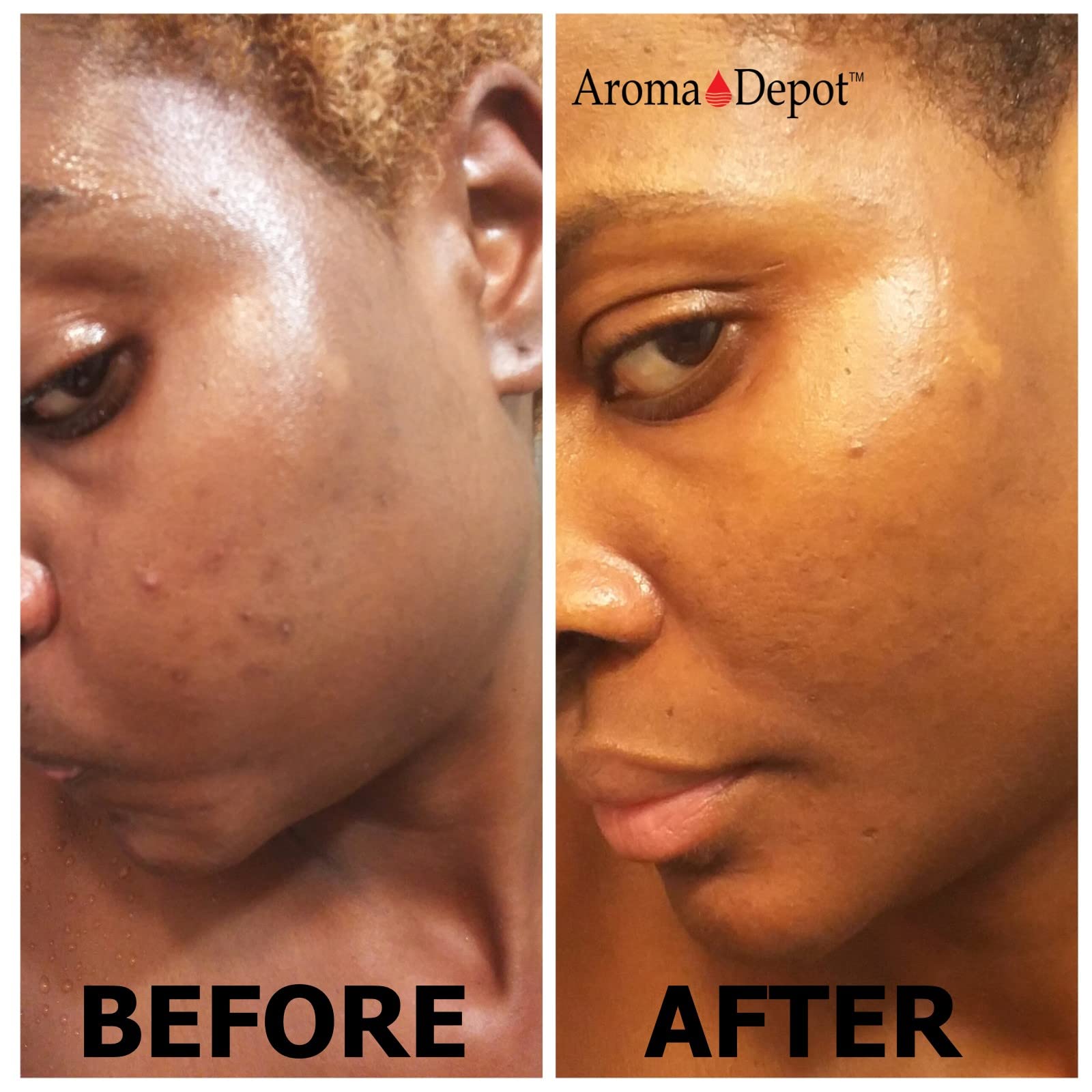 Aroma Depot Raw African Black Soap 8oz 100% Raw Natural soap for Acne, Eczema, Psoriasis, Scar Removal Face And Body Wash. Handmade