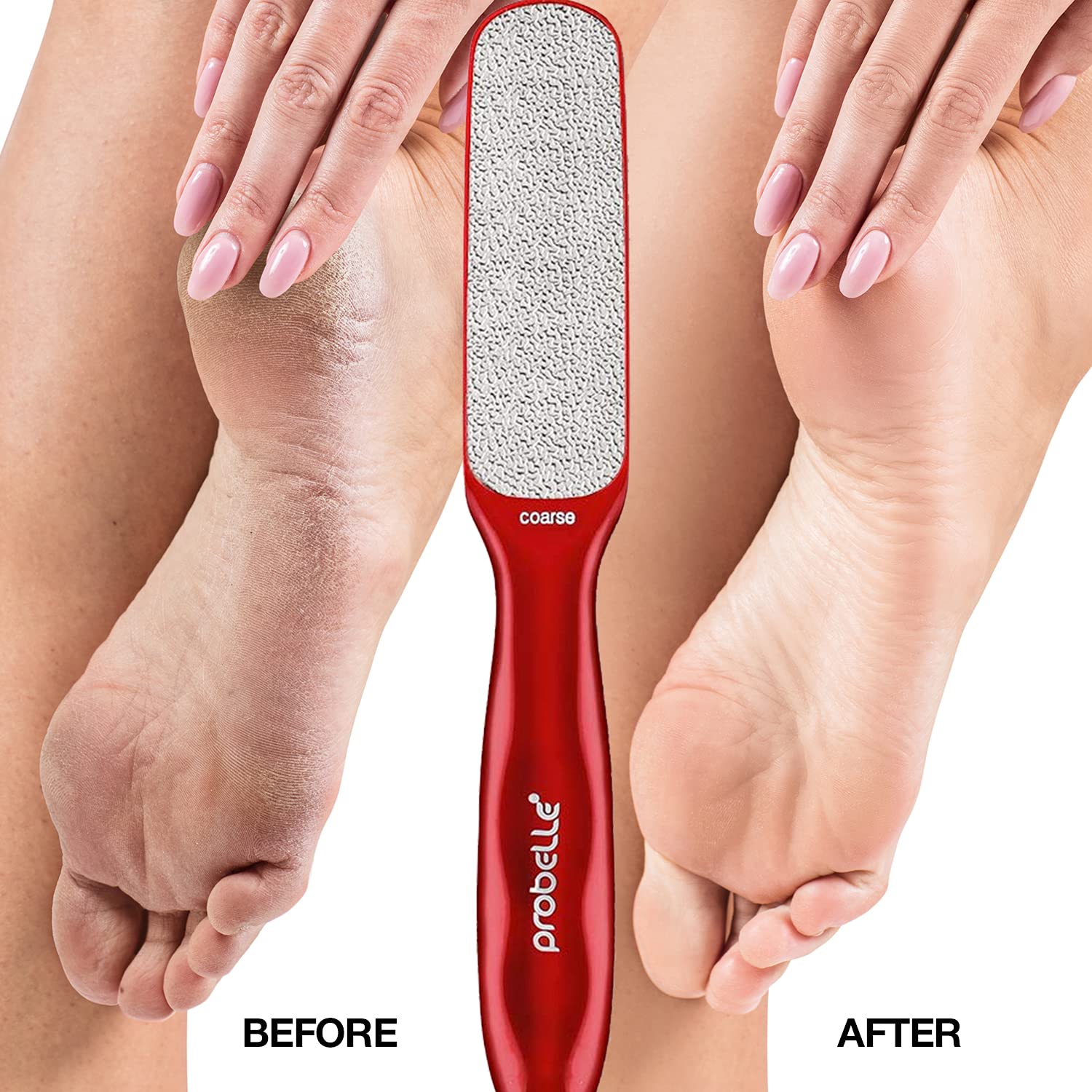 Probelle 2-Sided Hypoallergenic Nickel Foot File for Callus Trimming and Callus Removal, Red, 4 Ounce