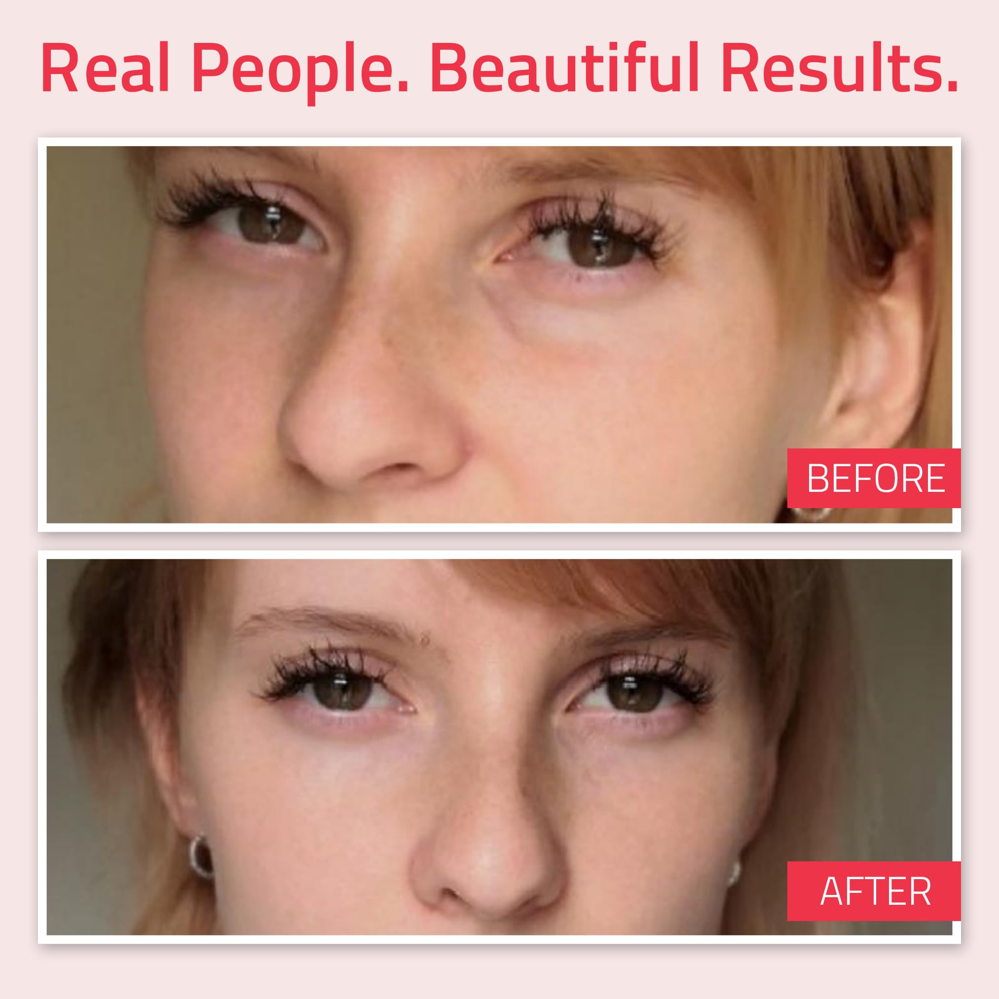 Retinol Eye Cream 2.5% from YEOUTH Boosted w/Retinol, Hyaluronic Acid, Caffeine, Green Tea, Anti Wrinkle, Anti Aging, Firm Skin, Even Skin Tone, Moisturize and Hydrate - Guaranteed