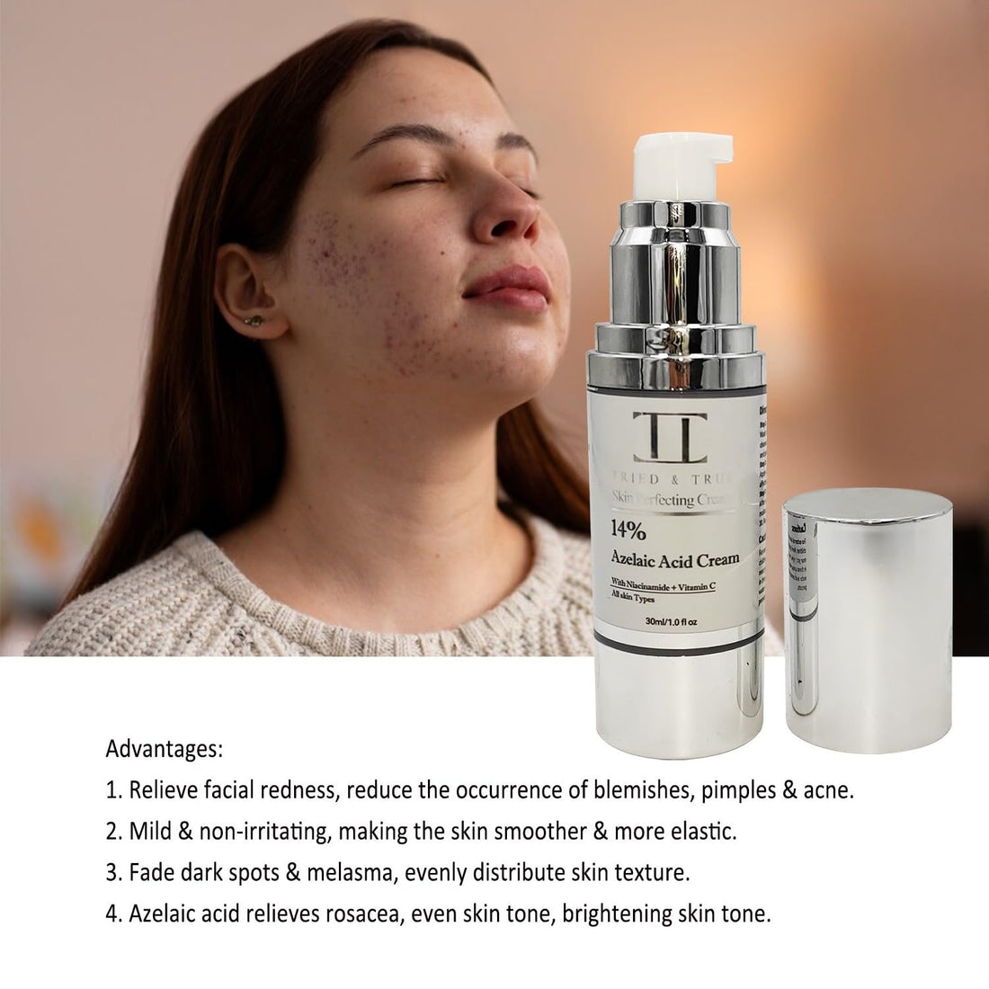 14% Azelaic Acid Skin Perfecting Cream, Reduces Redness, Fades Dark Spots, Evens Texture - Tried and True