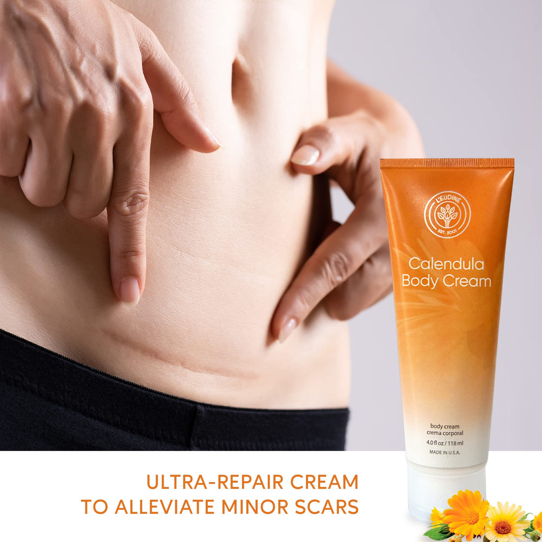 L’EUDINE Calendula Cream – 4fl oz Calendula Body Cream for Acne, Wrinkles, Fine Lines, Scars – Calming and Soothing Repair Cream – Natural Calendula Extract with Vitamin E, Echinacea