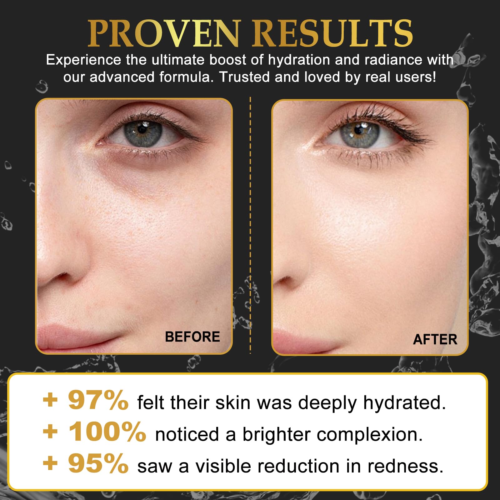 AFITMOE Snail Mucin Sheet Mask 6 pcs with Snail Mucin Serum, Self Care, Hydrating & Smoothing, Moisturizing & Nourishing for All Skin Types, Collagen Face Mask, Travel Essentials