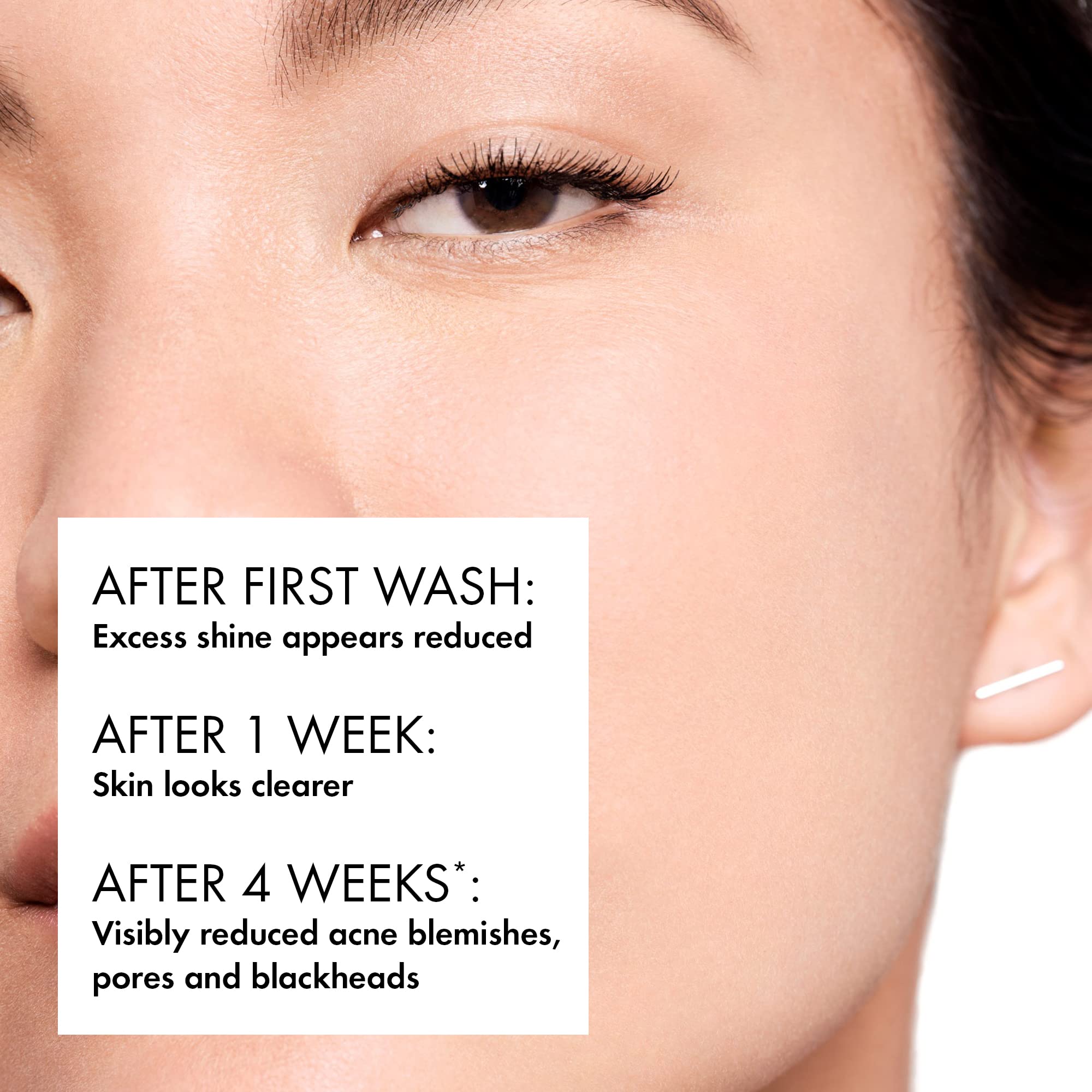 VICHY Normaderm Daily Acne Face Wash, 0.5% Salicylic Acid Cleanser, Gel Cleanser For Oily Skin, Removes Excess Oil, Dirt & Clogged Pores, Oil Free Acne Wash, Soap & Sulfate Free, Non-Drying