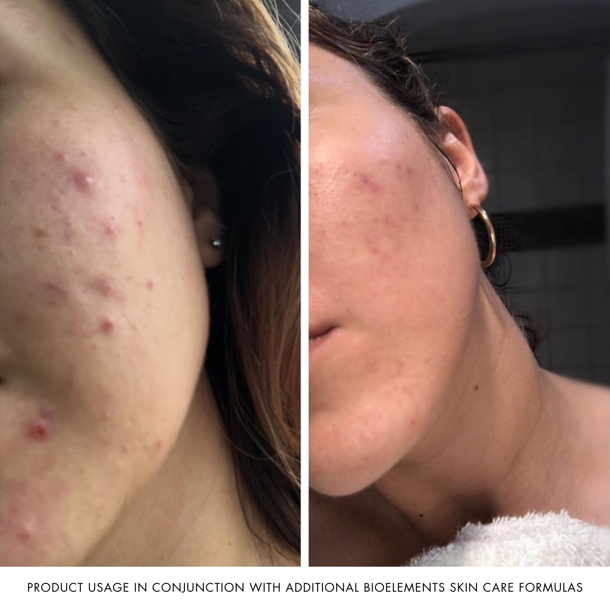 Bioelements Crucial Moisture, 2.5 Ounce