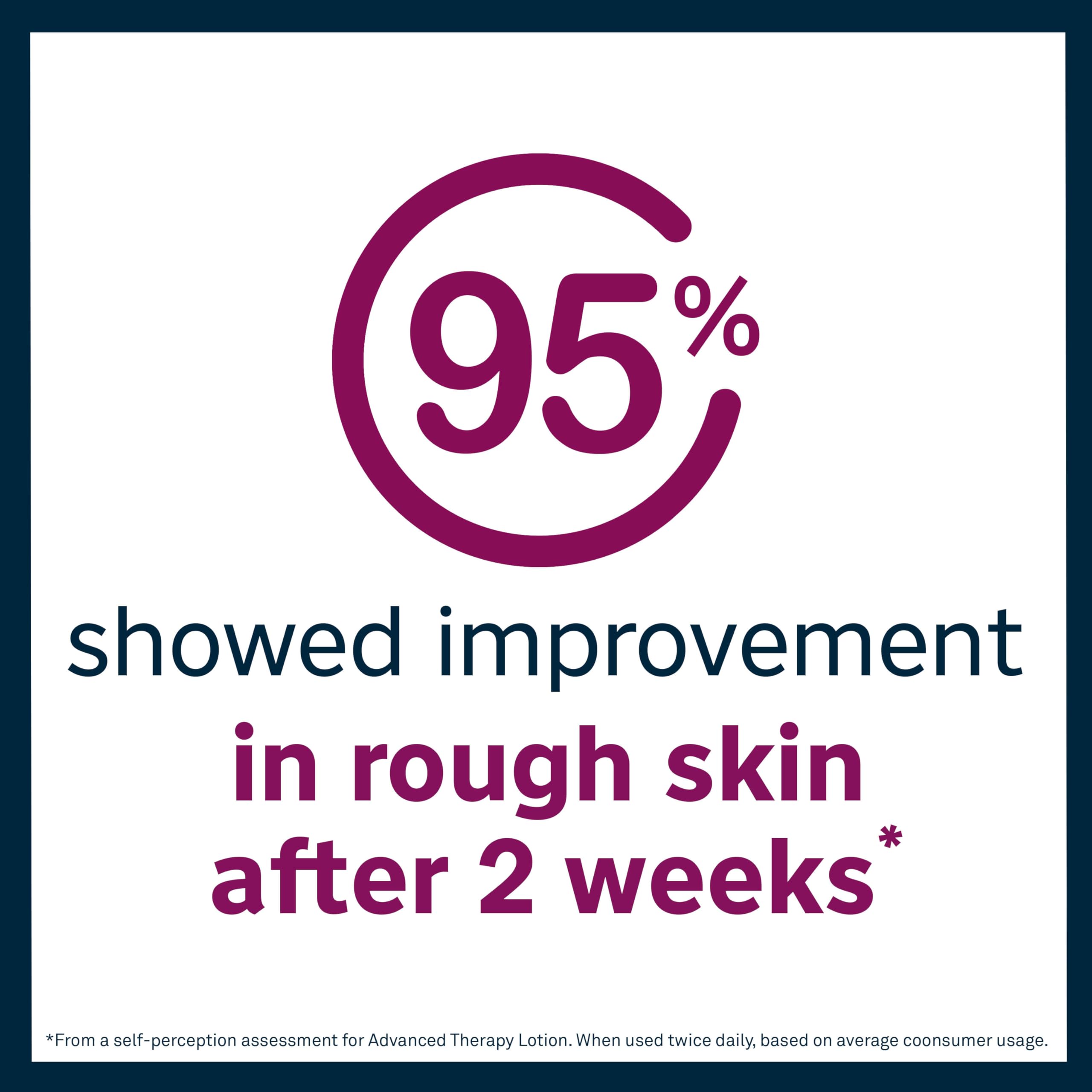 Lubriderm Advanced Therapy Fragrance Free Moisturizing Hand & Body Lotion + Pro-Ceramide with Vitamins E & Pro-Vitamin B5, Intense Hydration for Itchy, Extra Dry Skin, Non-Greasy, 6 fl. oz