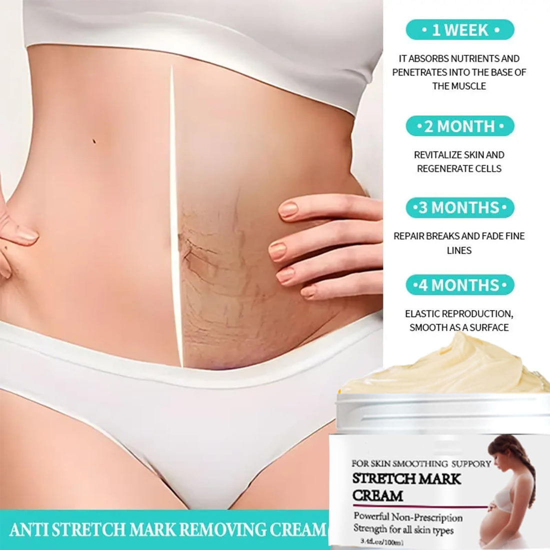 Rosarden Stretch Mark Prevention Cream for Pregnancy, Stretch Mark Cream Remover, Stretch Mark Lotion for Pregnancy, Tummy Butter for Stretch Marks Pregnancy, Shea Butter Stretch Mark Removal Cream