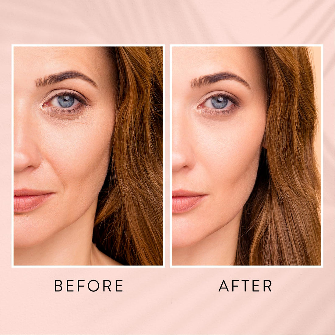 Cariposa Beauty Skin Renewing Retinol Serum for Face Anti Aging & Pore Refining - Firming Serum for Fine Lines - Resurfacing Retinol Serum for Acne Marks - Retinol for Beginners Mild Formula 0.1%