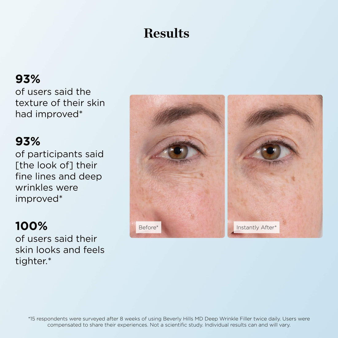 Beverly Hills MD Deep Wrinkle Filler- Decrease Appearance of Deep Wrinkles on Contact, Anti-Aging Serum for Smooth, Lifted Complexion- Helps Correct Fine Lines & Creases w/Diamond Dust & Polymers