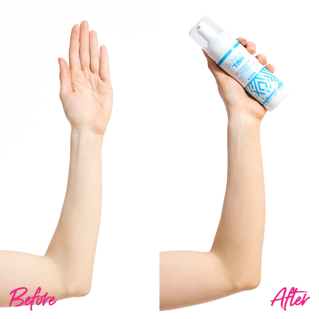 Skinny Tan Mousse - No Orange, No Streak, Cellulite Reduction Lotion All Skin Types